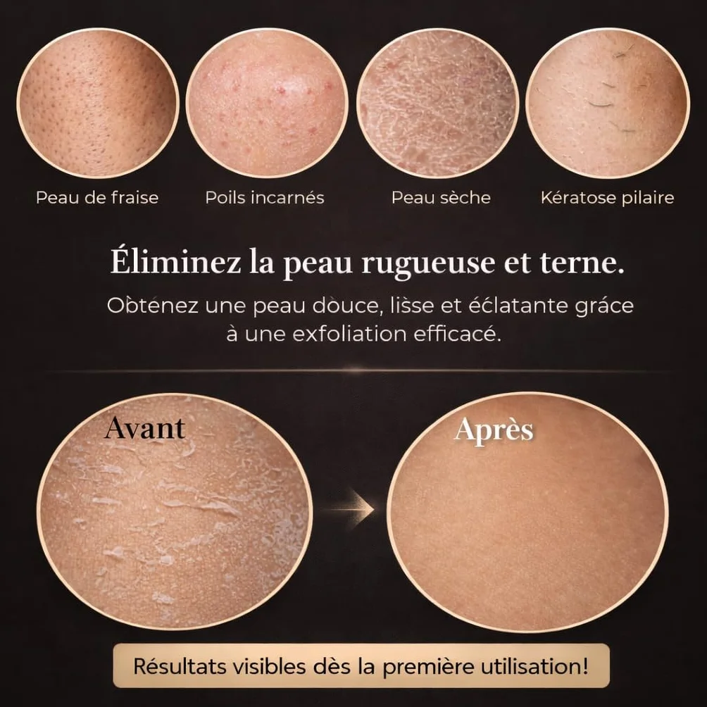 Gant Exfoliant Kessa - Gant De Crin Gommage Corps Et Visage - Nettoie Et Purifie En Profondeur (Noir/Rose, Standard)