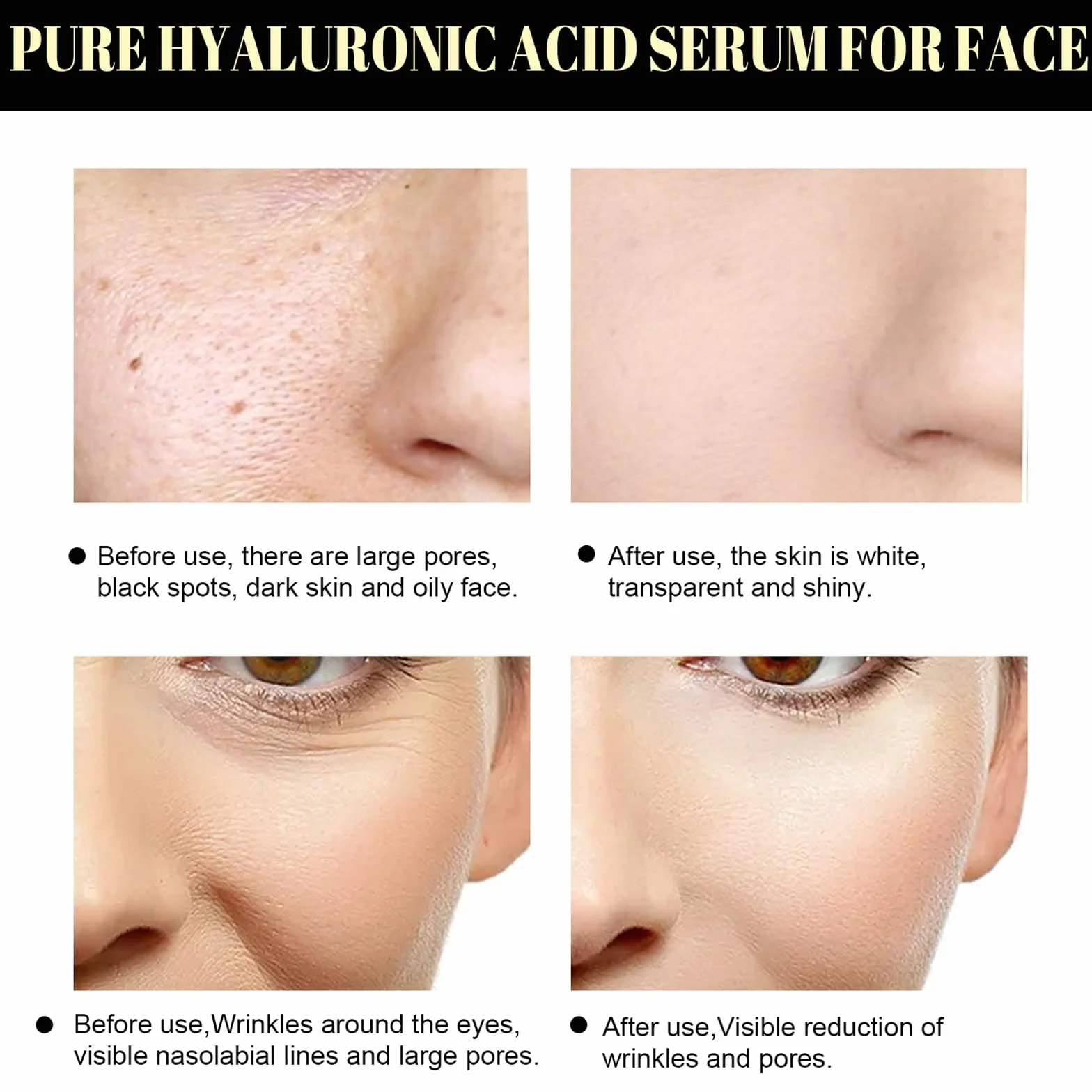 Kit De Levage De Fil Protéinés Visage, Sérum Facial Raffermissant Anti-Rides