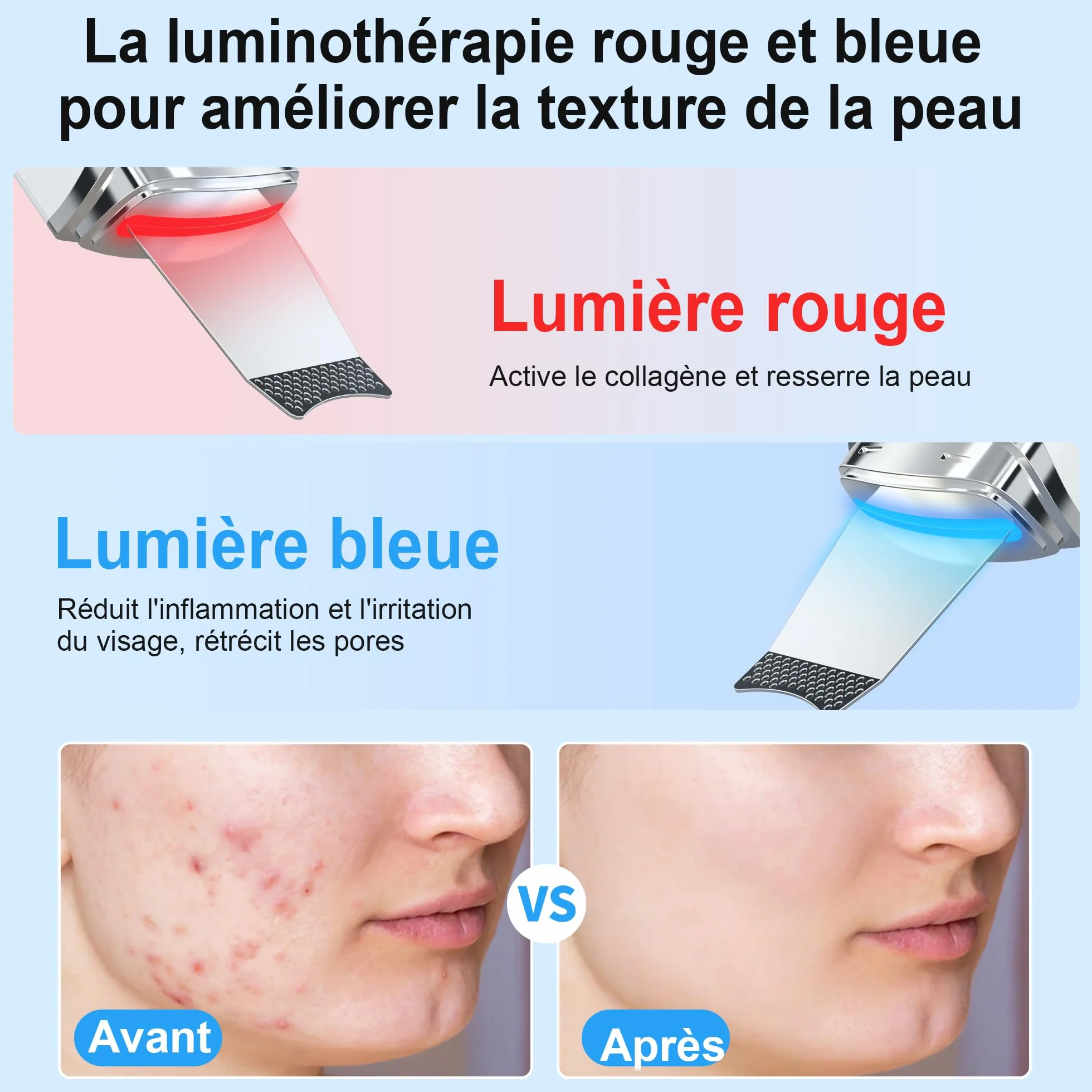 Épurateur de Peau à Ultrasons, Épurateur Visage Skin Scrubber avec 4 Modes et Intensité Réglable, Lumière Rouge et Bleue, Appareil de Nettoyage Exfoliant à Ultrasons