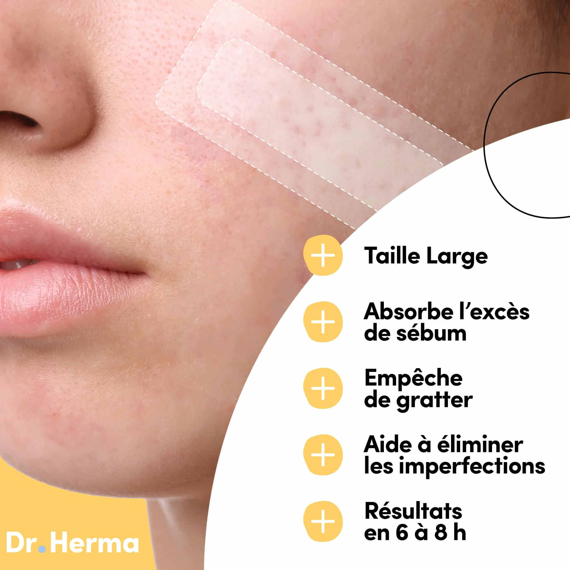 Dr. Herma Patch Anti Bouton XL Acide Salicylique Hydrocolloïdes Huile d'Arbre à Thé 10 patchs
