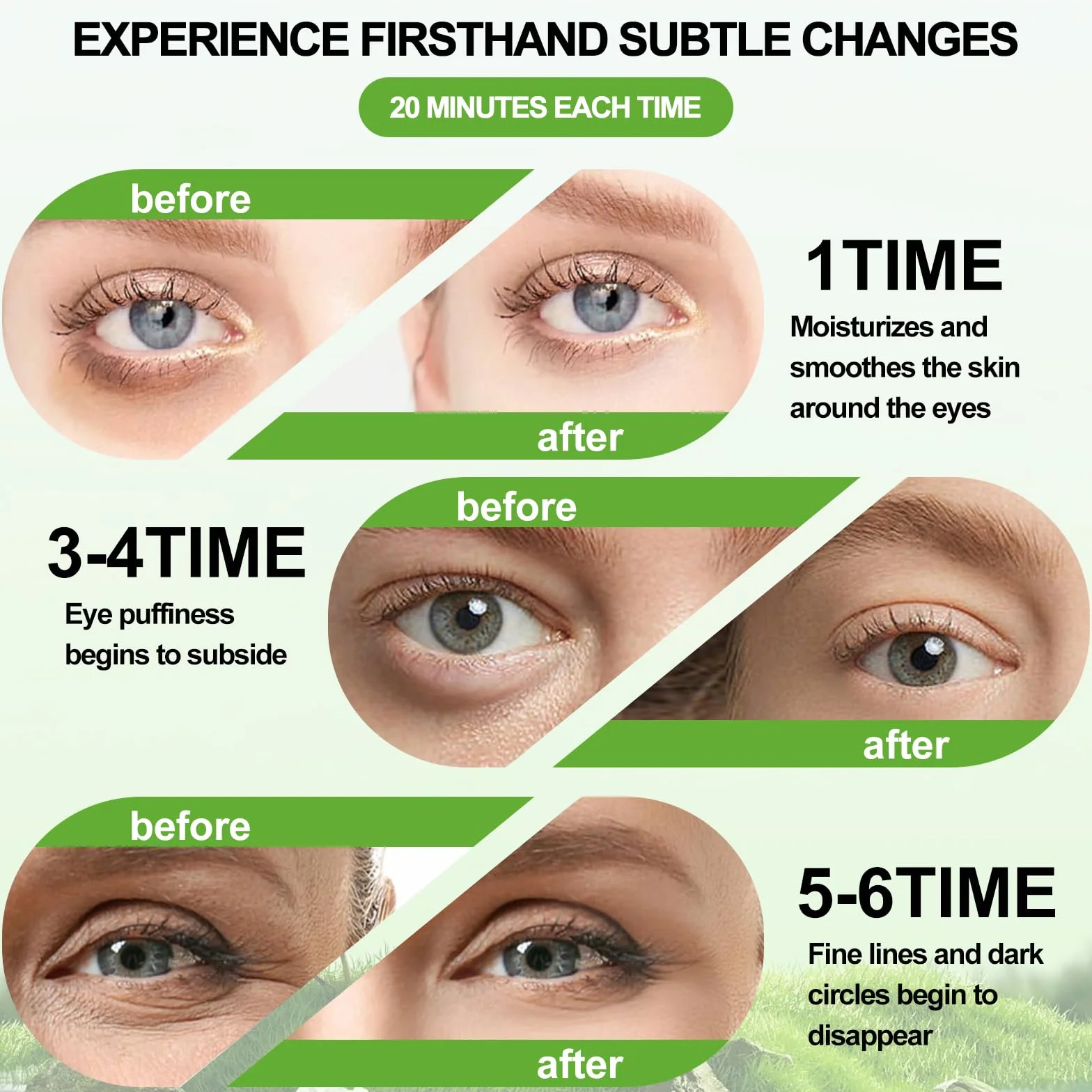 Aloe Vera Patchs Yeux 60 Pièces Anti Cernes Masque Collagène Contour des Yeux