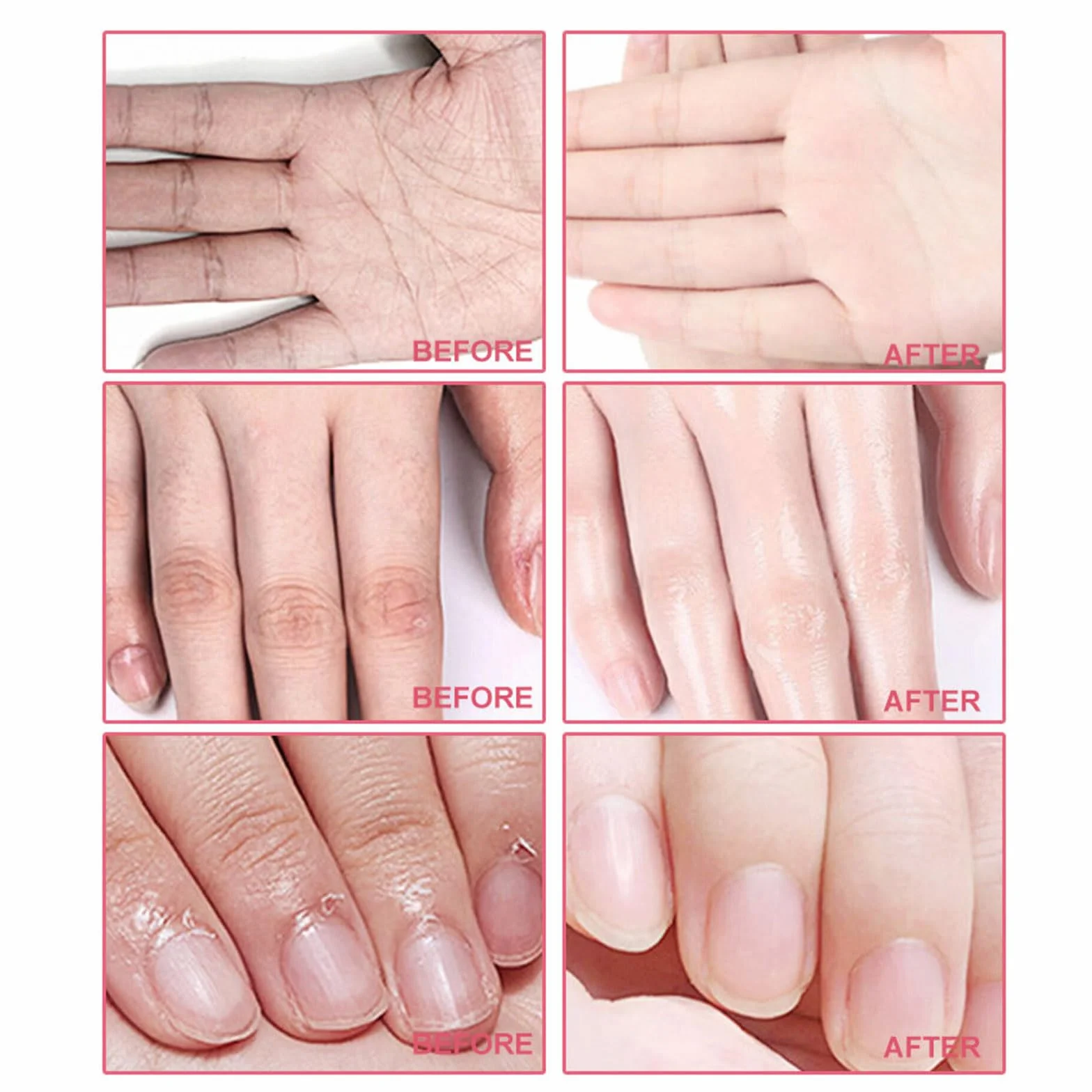 Masque pour Mains Hydratants Exfoliants 5 Paires Gants Soin Peaux Sèches Anti-âge