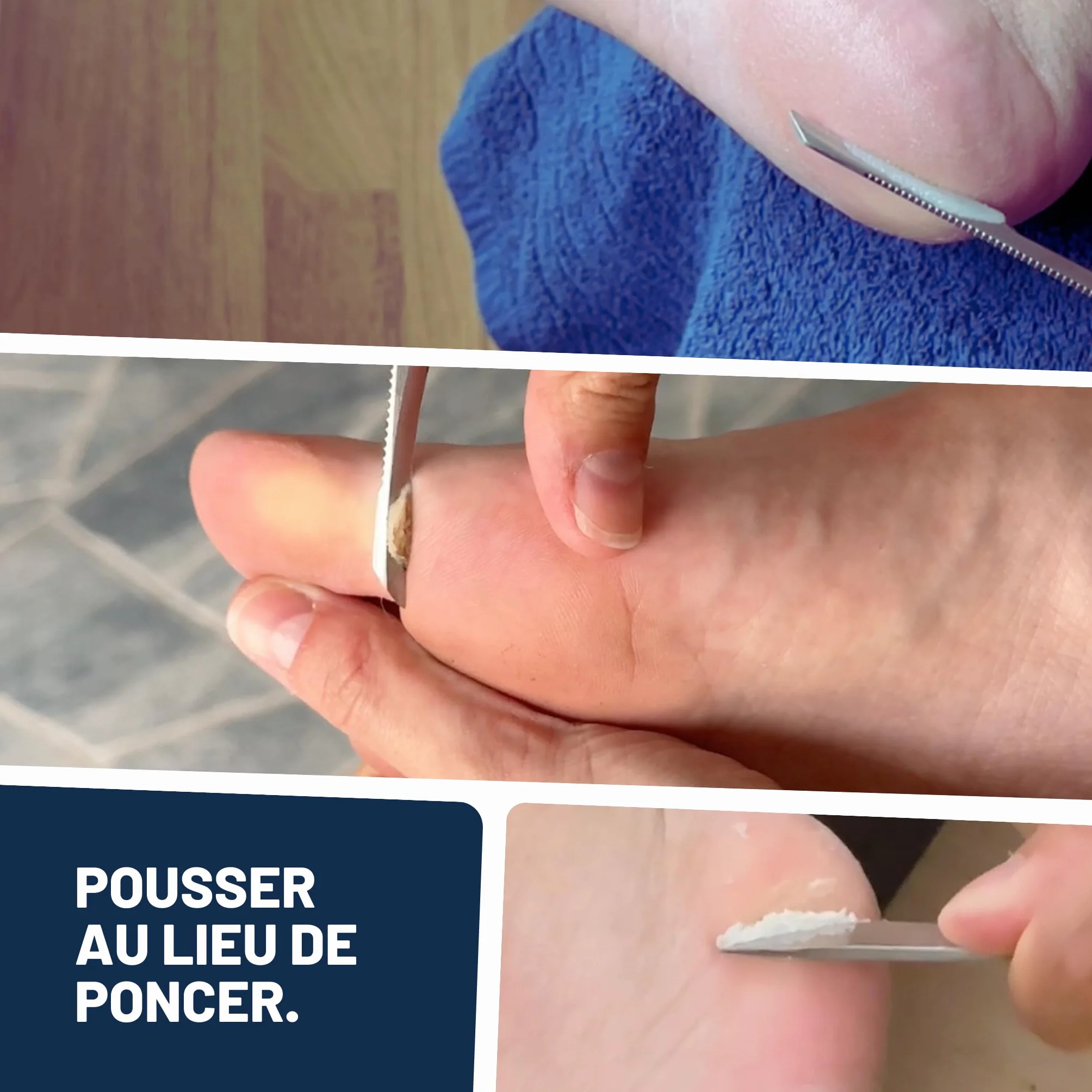 Mr. Fuss Solution Anti Callosités Dissolvant Pour les Cornes Lotion 250ml Set de Pédicure
