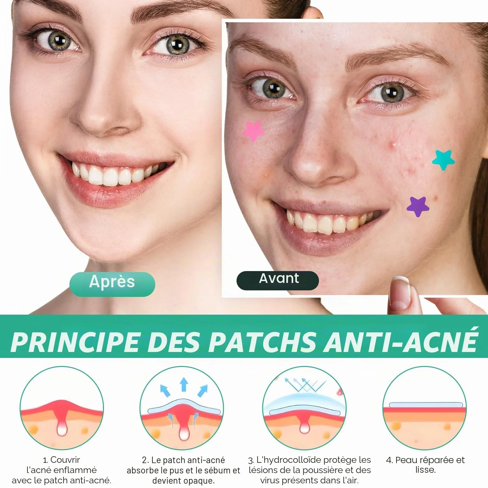 400PCS Pimple Patches Star, Hydrocolloïde Anti Bouton Patch avec Huile Tea Tree & Acide Salicylique, Acné Patches Imperméables (10/12/14 mm)