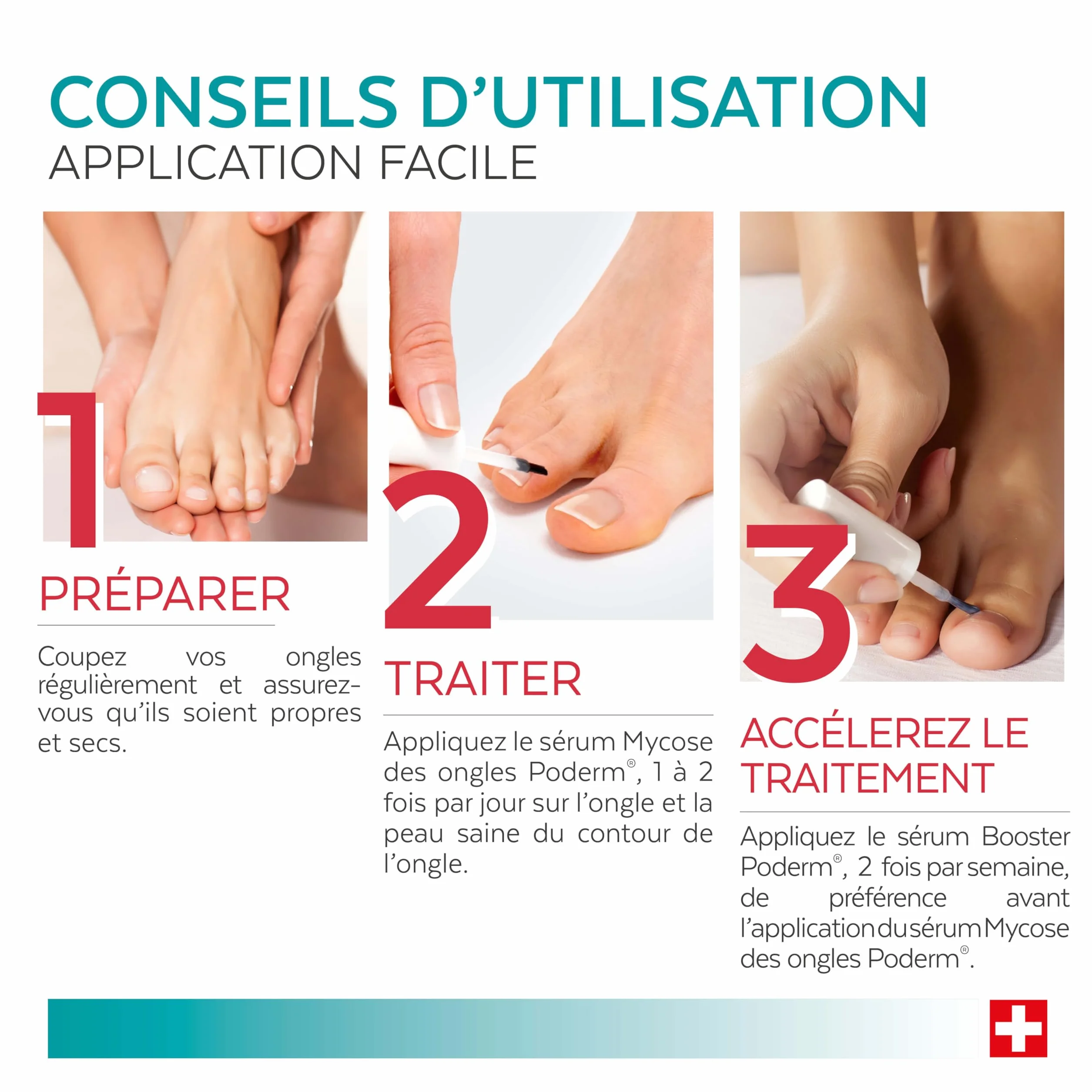 PODERM 2en1 Traitement Mycose Ongles des Pieds Pack Duo Sérum Booster Soin Puissant Rapide Ongles Jaunes Cassants Abîmés 100% Naturel Podologue Suisse