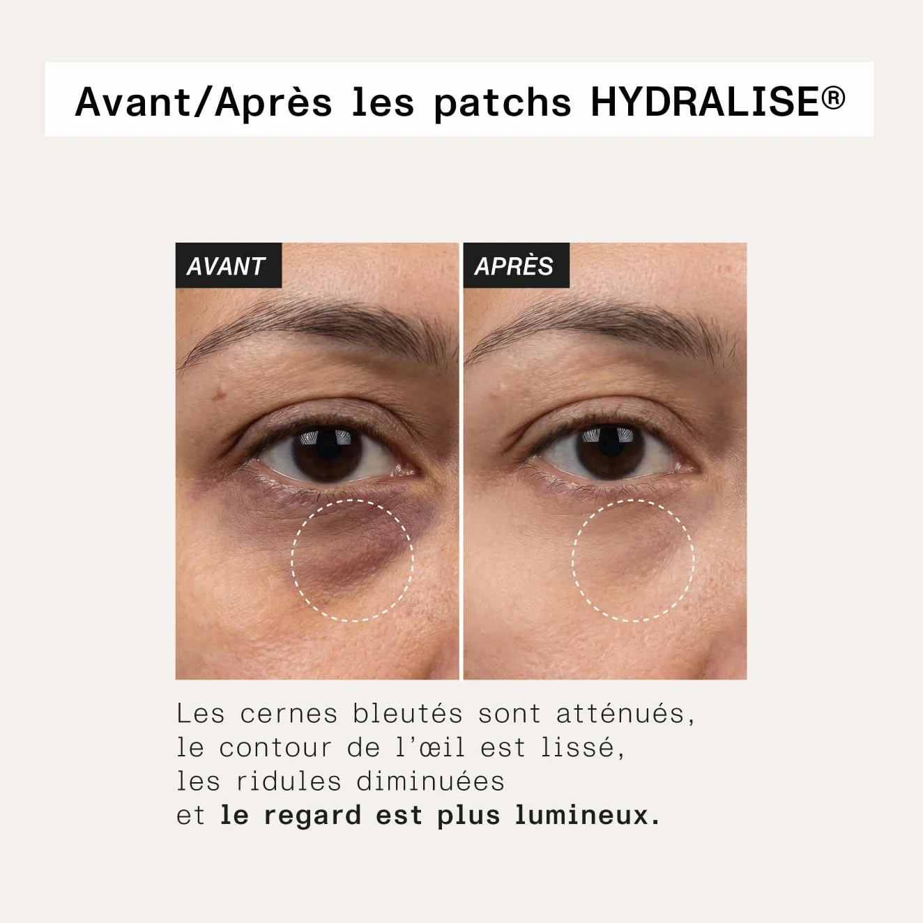 Patchs Anti-Cernes Aloe Vera Collagène Marin 30 Paires Hydratants Contour des Yeux Réduire Cernes Poches Fatigue