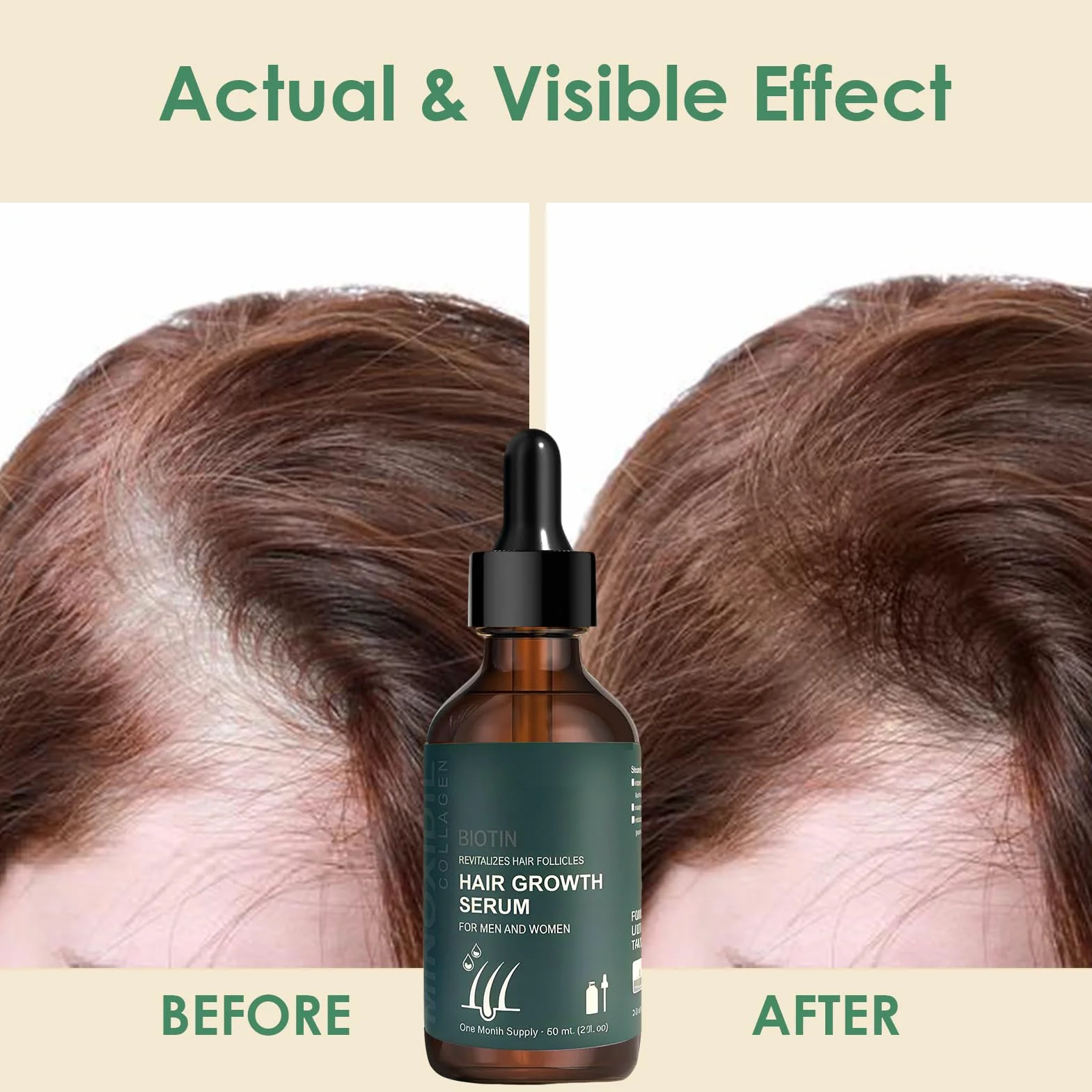 Sérum de Croissance des Cheveux 60ml avec Rouleau 0,5 mm, Huile pour Cheveux, Épaississement et Renforcement, Contre la Chute