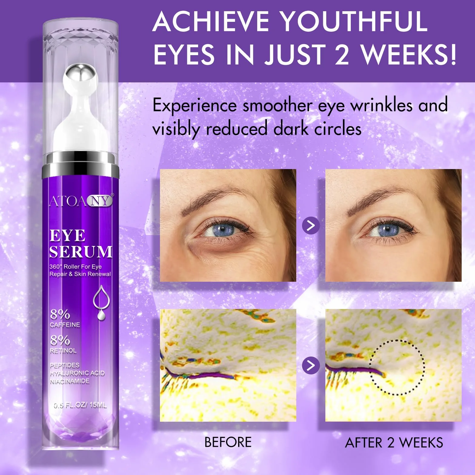 Sérum yeux cernes poches 8% caféine 8% rétinol crème anti-âge 360° Eye Roller Massage Ball 15ml