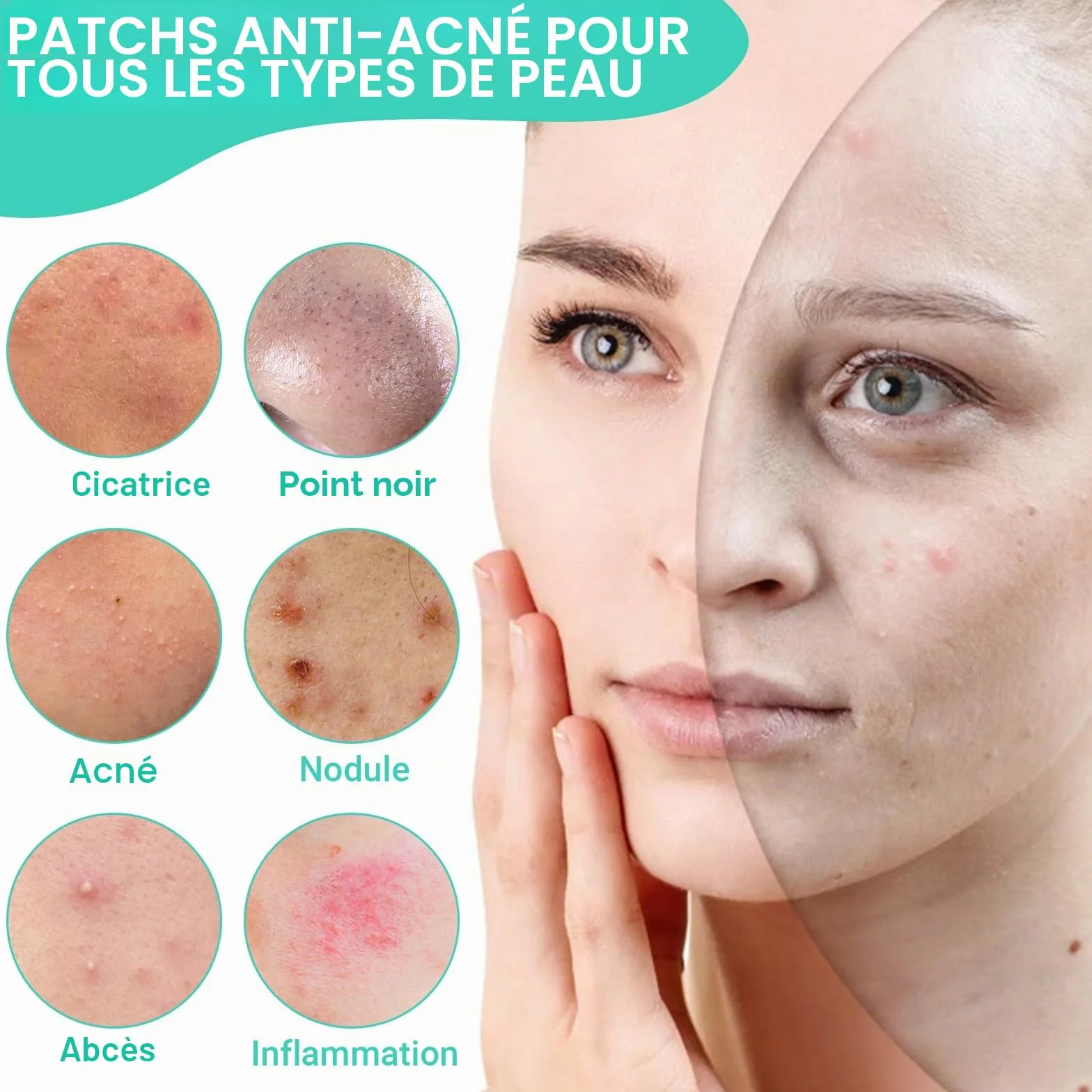 Patch Bouton 200 Patchs – Pimple Patch Invisible Jour & Nuit, Anti-Acné Hydrokolloïde, Sans Parfum, Végan