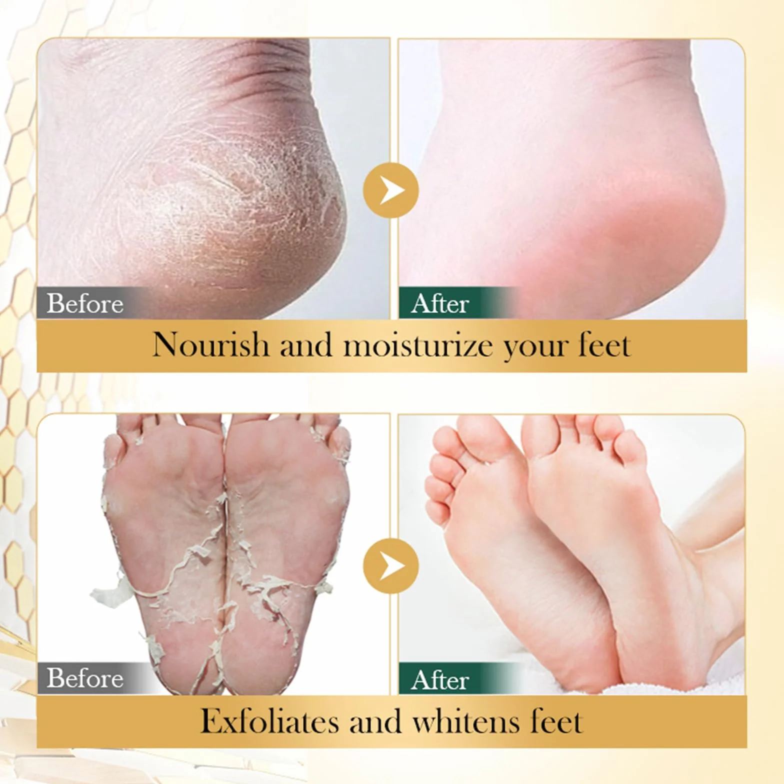 Masques pour les mains et les pieds au miel, soin intensif peau sèche, 6 paires