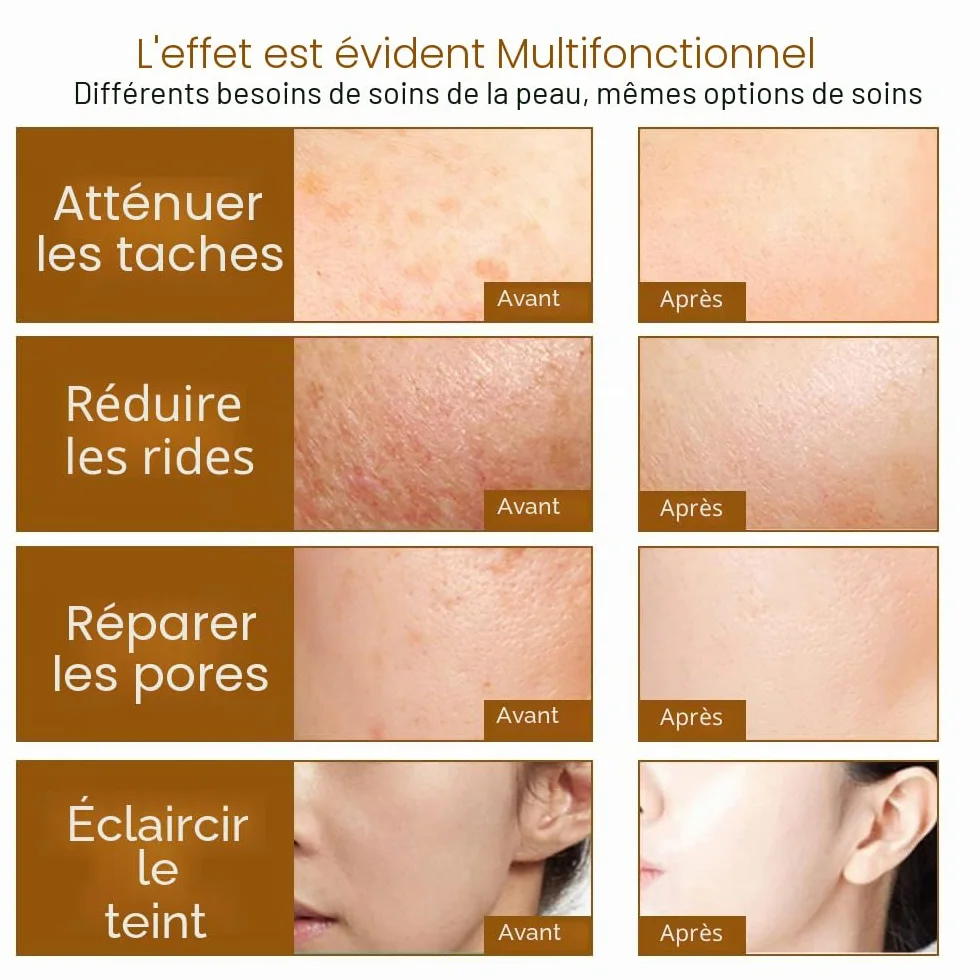 192 Dermaroller Système de Micro-aiguilles en Titane Outils de Soins de la Peau du Visage pour le Traitement du Visage, la Repousse des Cheveux, la Croissance de la Barbe,1.5mm