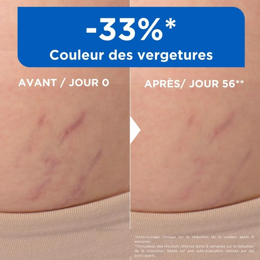 Mixa Huile Anti-Vergetures 30% Omégas 6 & 9 100 ml