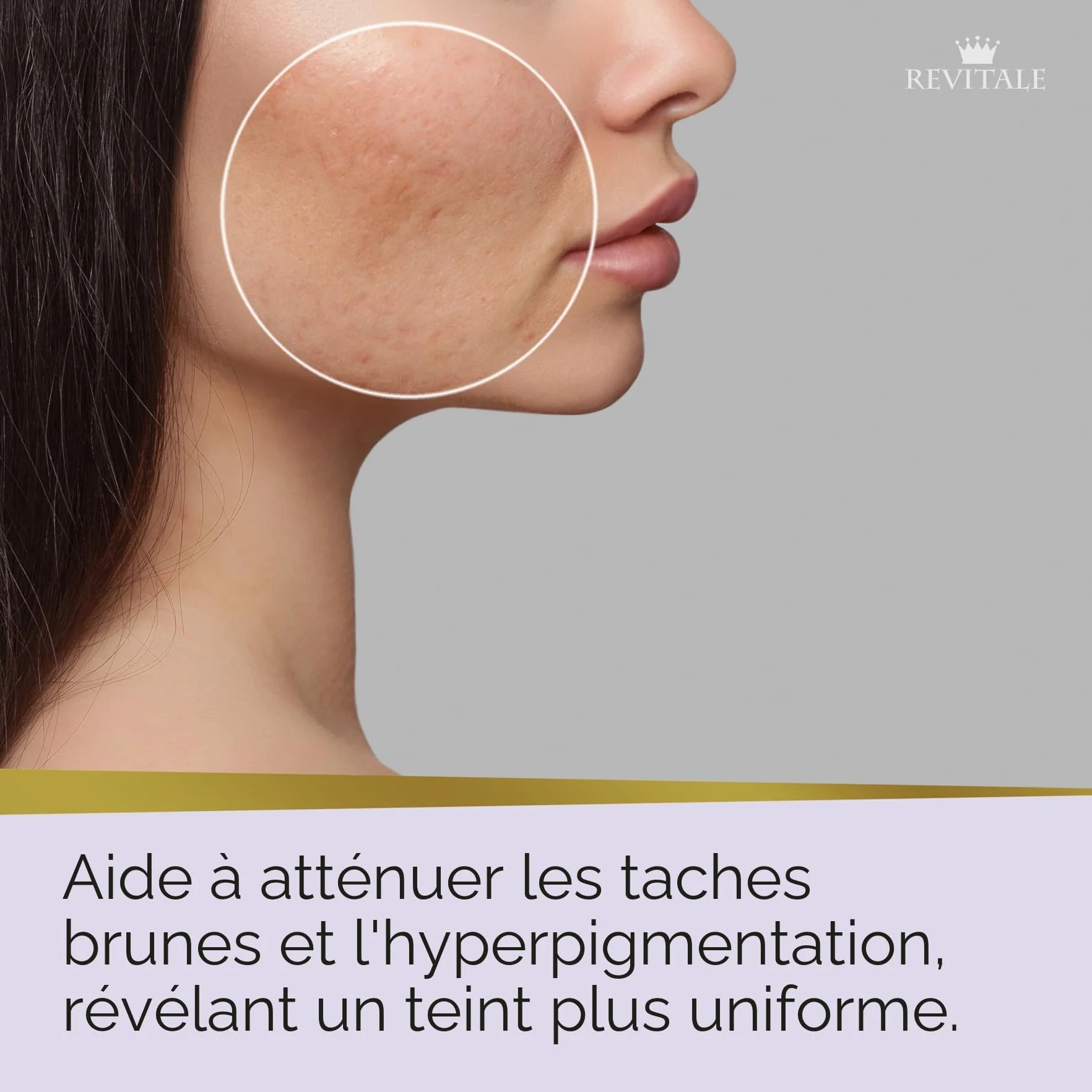 Revitale Savon Avancé à l’Acide Azélaïque et à la Niacinamide – Barre Nettoyante Apaisante pour Peau Lisse