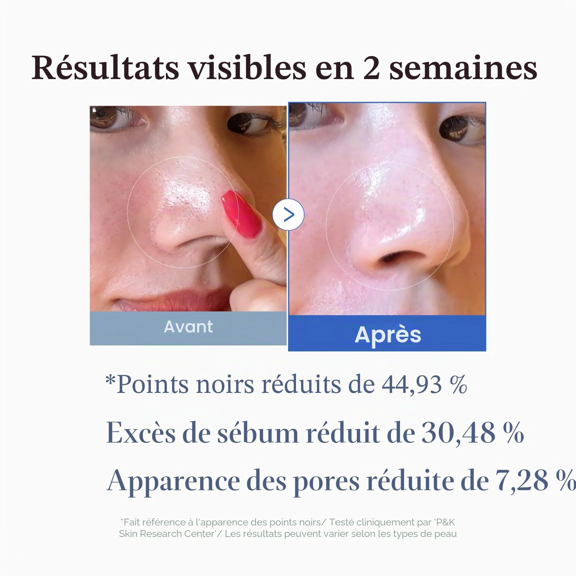 Medicube Zero Pore Pads 2.0, Tonifiants Visage Double Texture Exfoliation Soin Pores 4,5% Acide Lactique AHA 70 Pièces