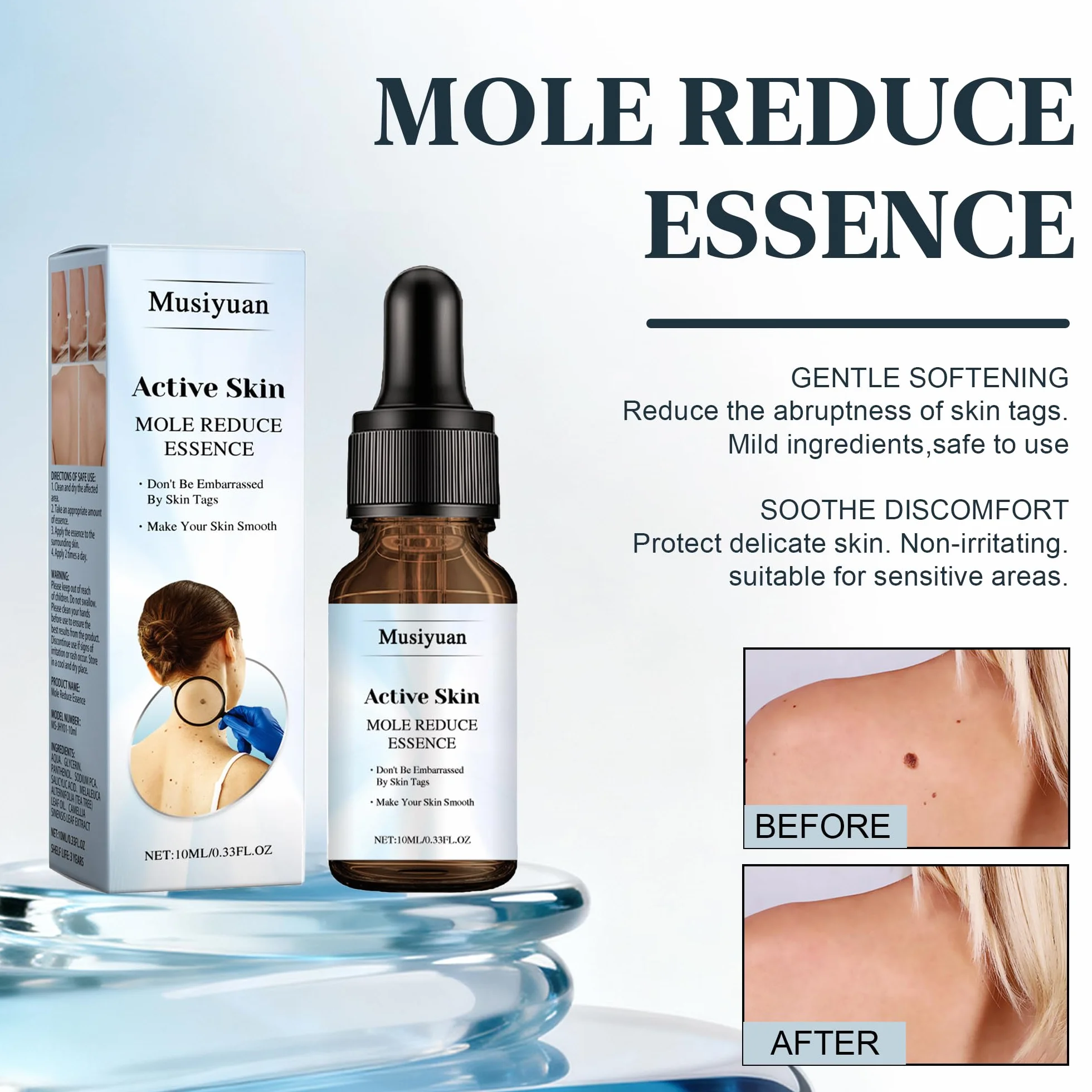 Anti Verrue Plantaire 10 ml | élimination Des Acrochordons | Soin Localisé pour Pieds et Mains