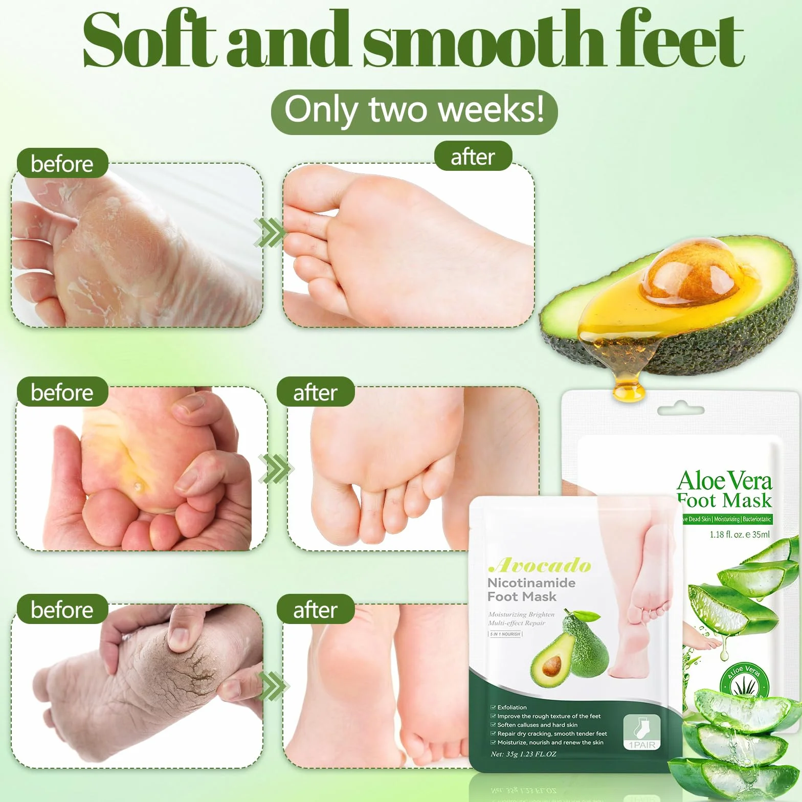 Masque Pieds Peeling Exfoliant Aloe Vera Avocat, Chaussettes Nourrissantes pour Peaux Sèches