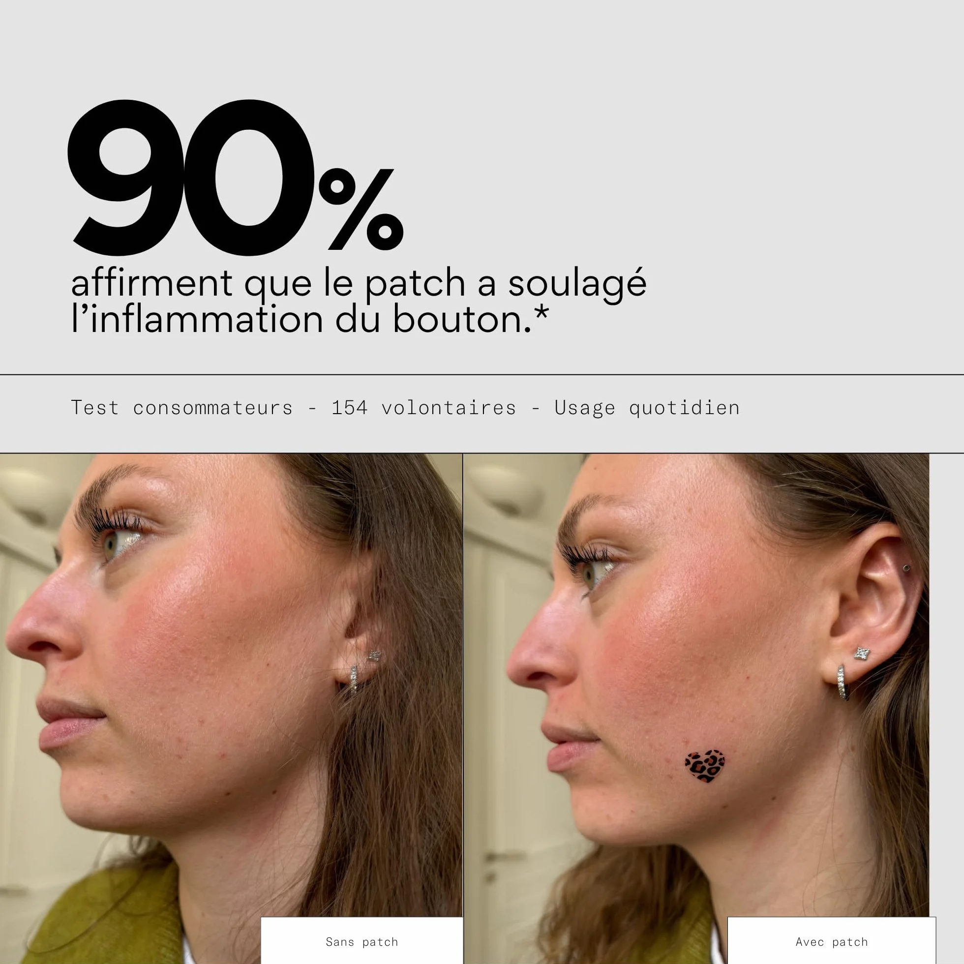 Patchs boutons édition limitée léopard x15 - Traitement de l'acné - Soulagement rapide, invisible sous le maquillage