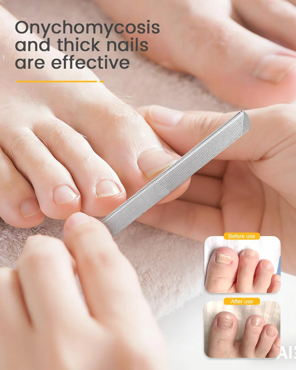 Lime à ongles longue en acier BEZOX pour onychomycose, ongles incarnés et ongles épais