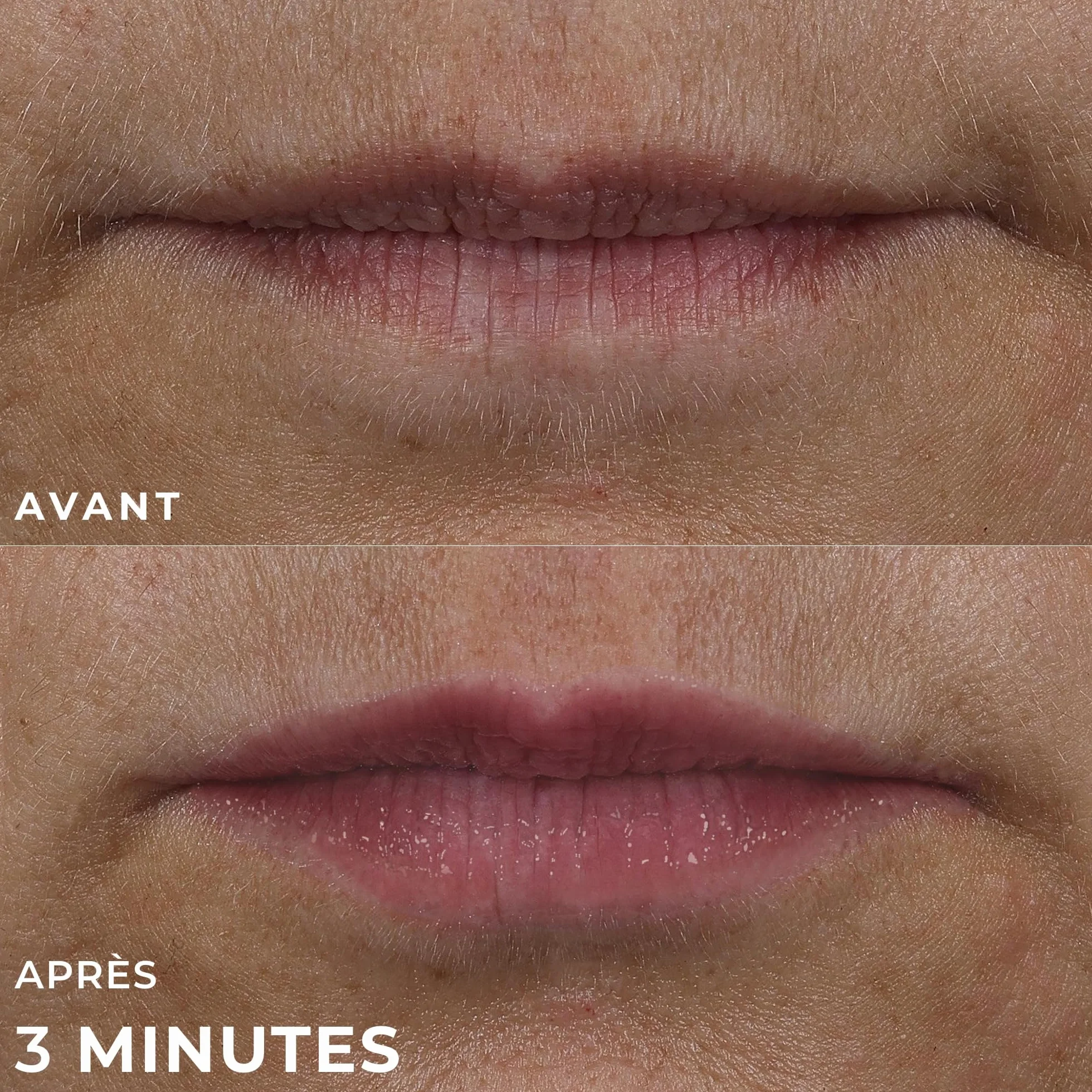 RoC Derm Correxion Lip Volumizer Baume Repulpant Acide Hyaluronique Peptides Collagène 10 ml