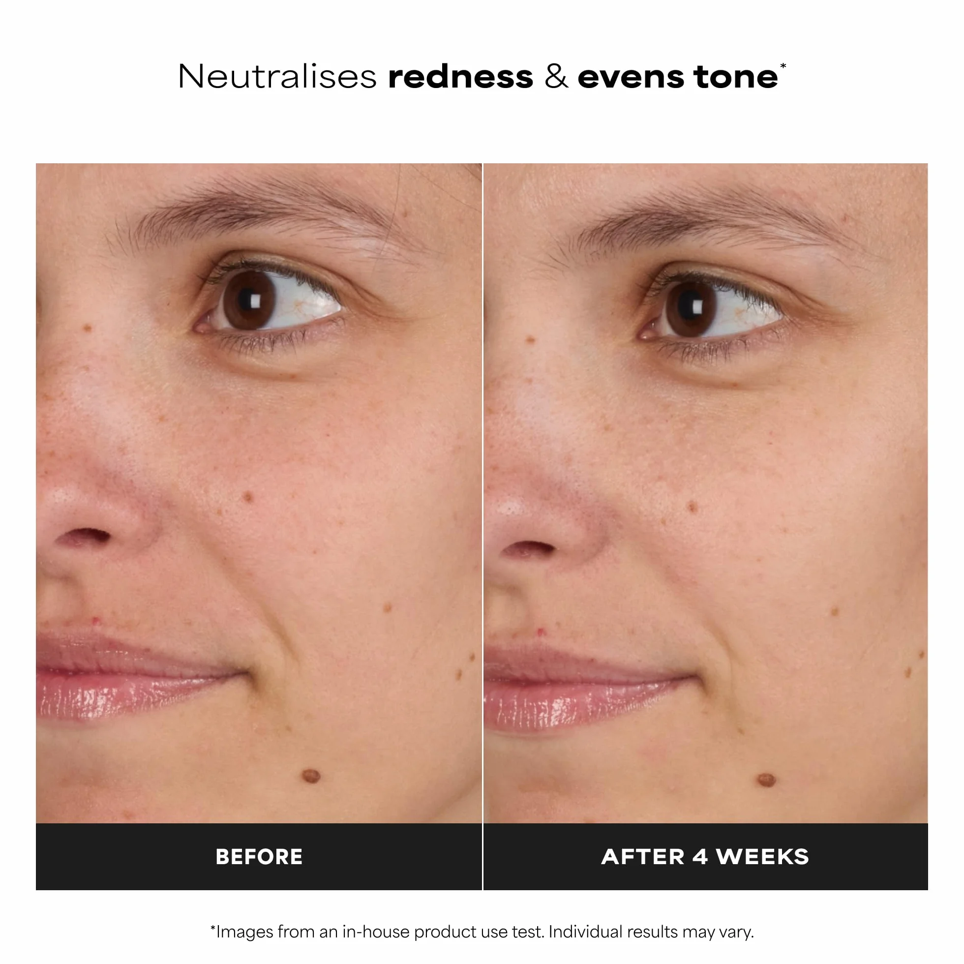 Paula's Choice SKIN BALANCING Lotion Tonique Visage - Vitamin B3 Tonique - Réduire Les Points Noirs, Imperfections & Pores Dilatés - avec Niacinamide - Peaux Mixtes à Grasses - 190 ml
