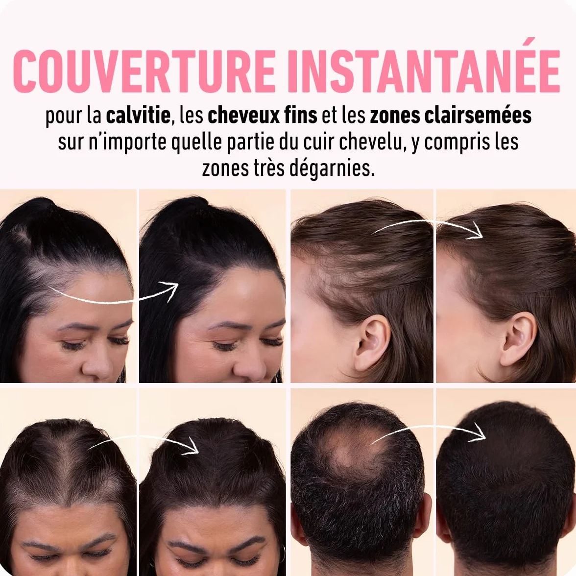 BOLDIFY Poudre de Racine de Cheveux Marron Foncé, Retouche Racines Instantanée, Camoufle Cheveux Gris, 4g