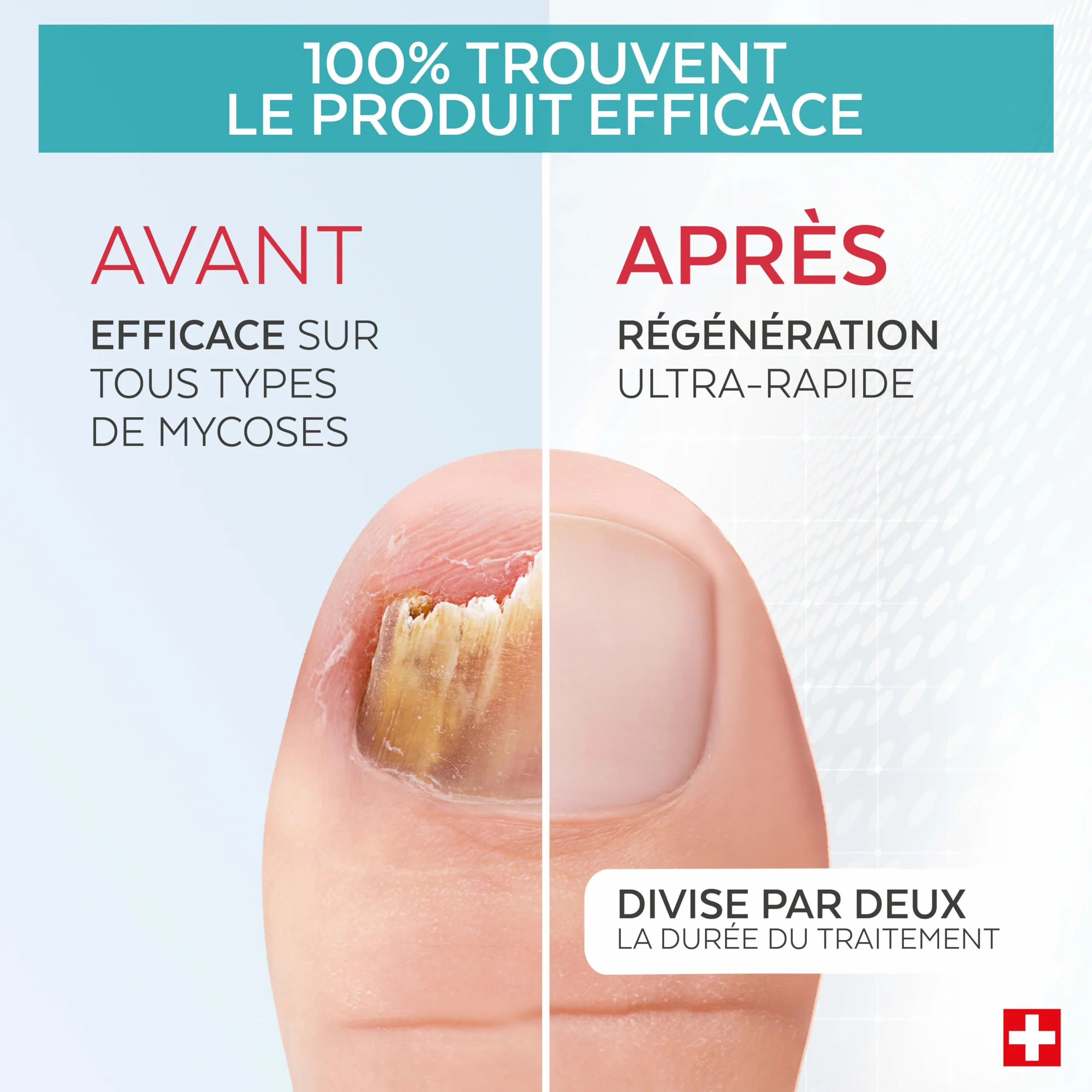 PODERM MYCOSE ONGLES BOOSTER DE TRAITEMENT pour mycose difficile à traiter | Swiss Made incolore