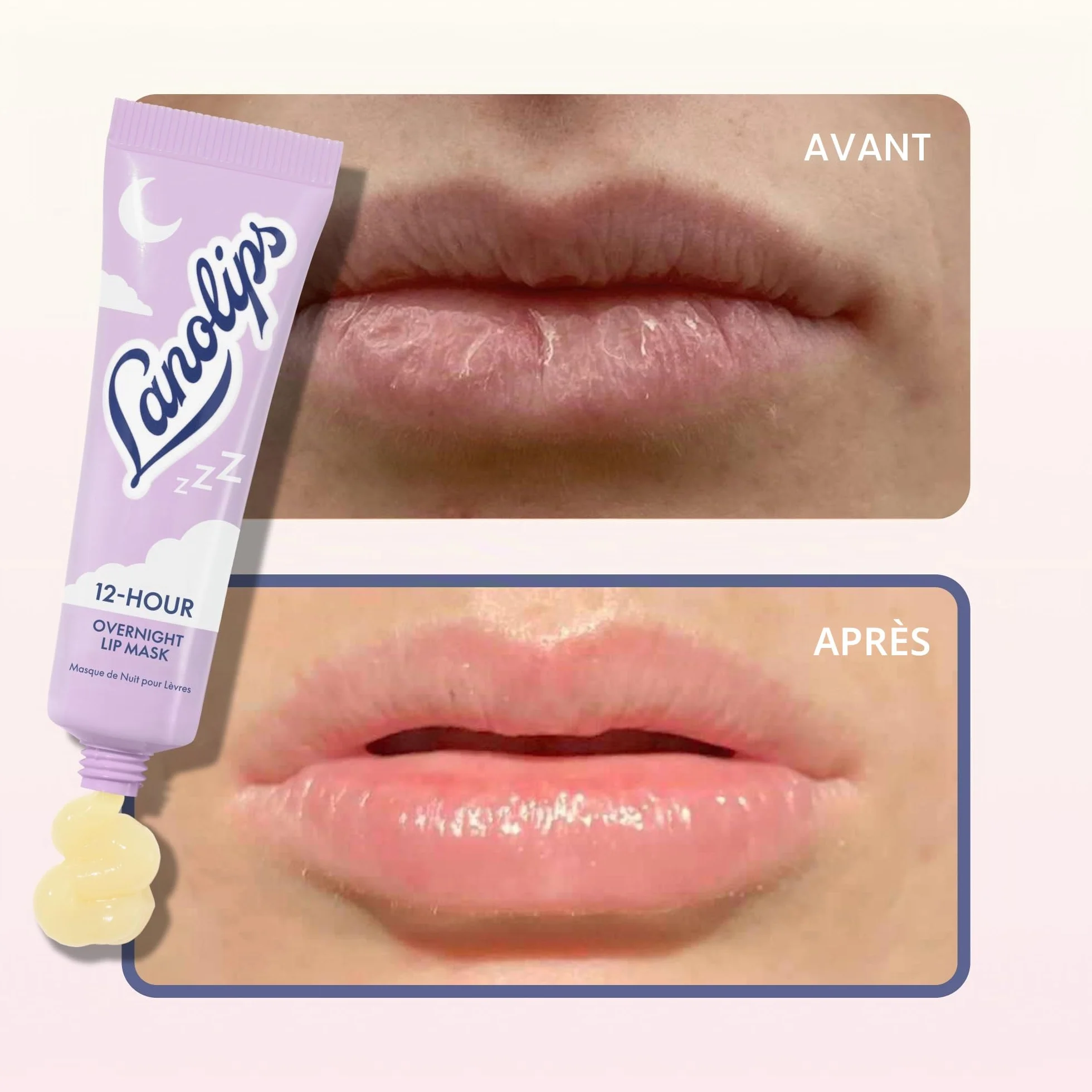 Masque à lèvres de nuit 12 heures – Hydratant riche pour les lèvres avec acide hyaluronique, vitamine C et céramides – Restaure, adoucit et régénère les lèvres pendant que vous dormez – Soin des
