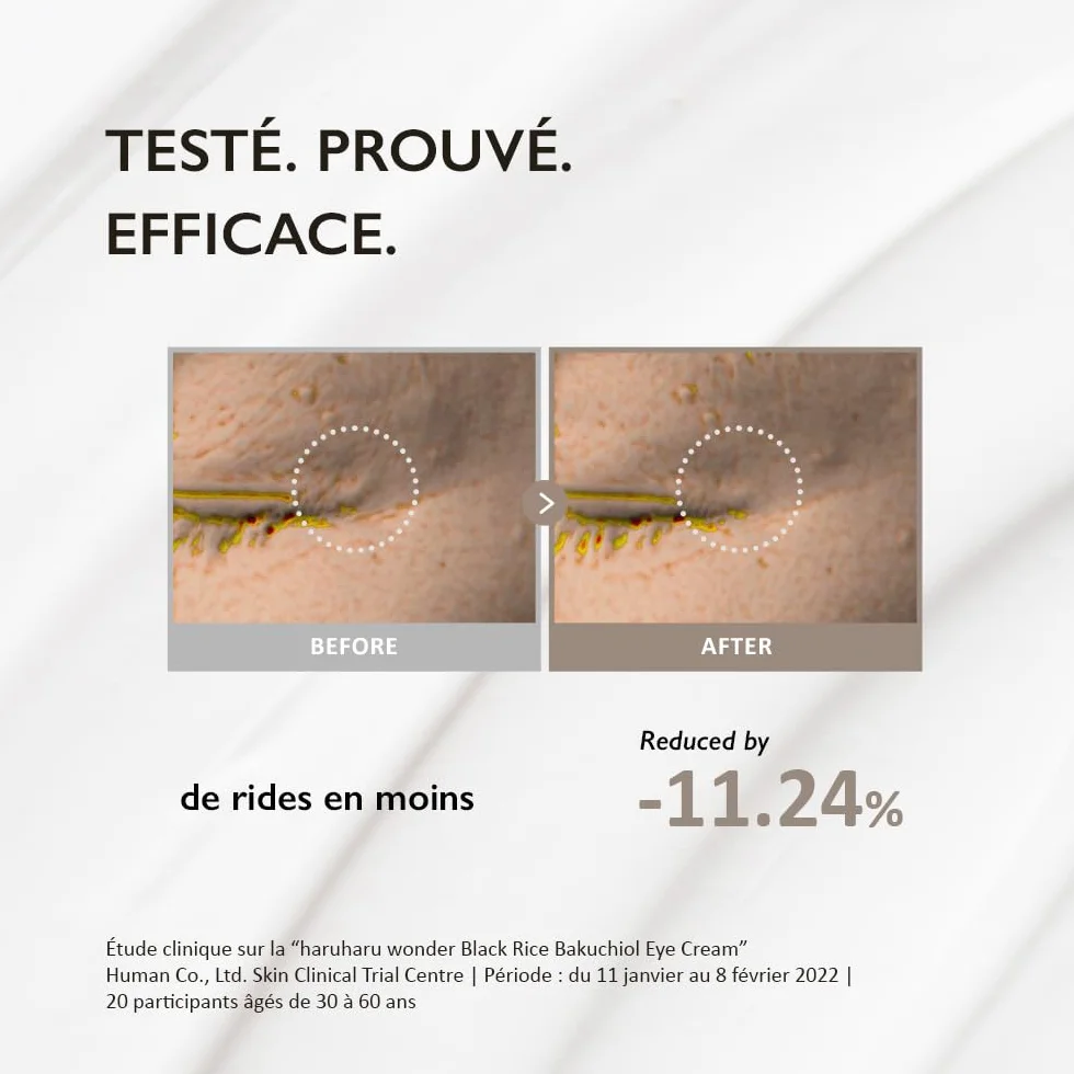 HARUHARU Wonder Black Rice Bakuchiol Crème contour des yeux 20 ml Anti rides alternative naturelle au rétinol
