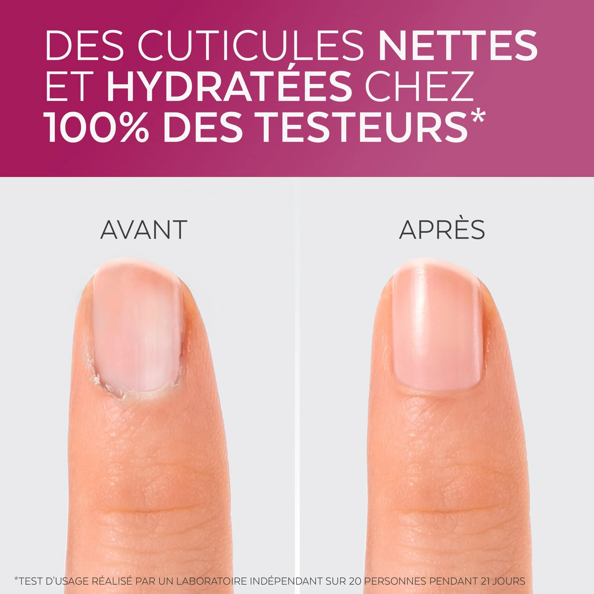 Poderm Cuticle Remover 2en1 Exfolie Hydrate Peaux Mortes Swiss Lab