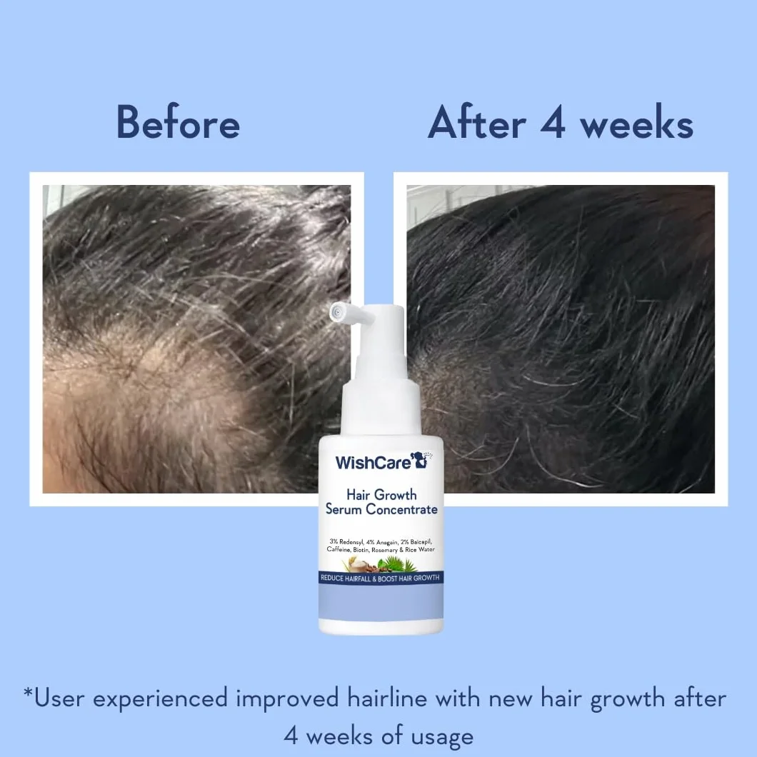 Sérum de croissance des cheveux WishCare avec romarin, Redensyl, Anagain, Baicapil, caféine, biotine