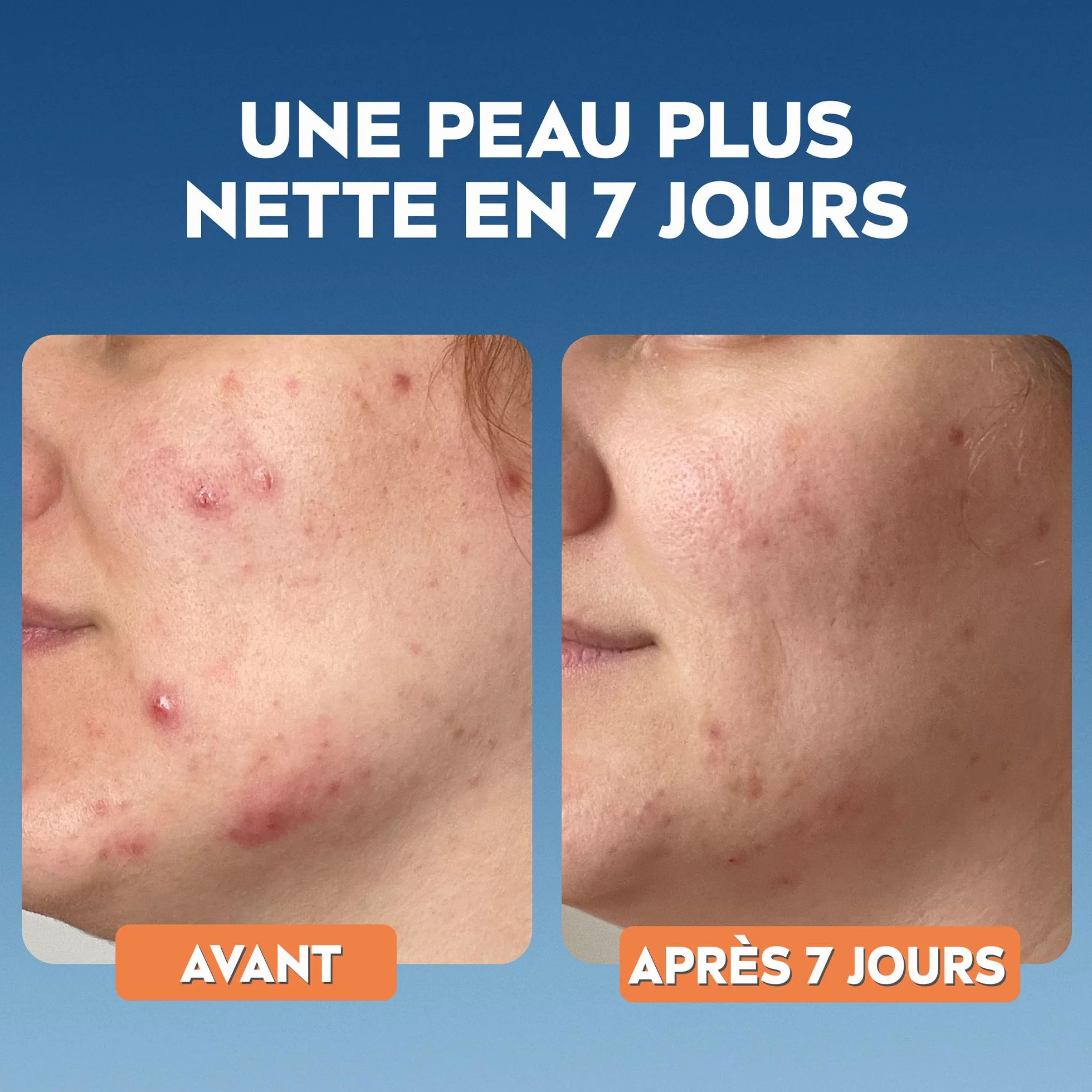 NIVEA Gel Nettoyant Visage Derma Skin Clear Acide Salicylique Sel Marin Niacinamide Peaux À Imperfections 150 ml