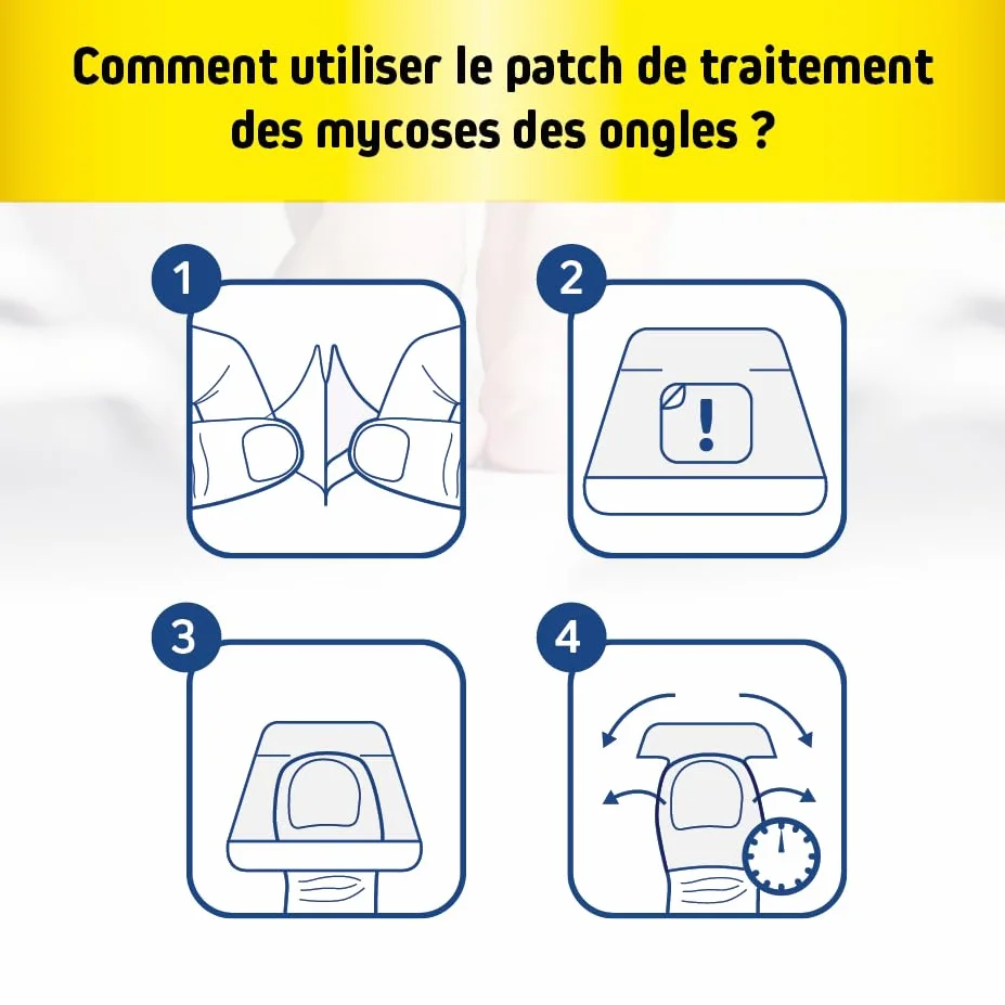 Patch de traitement des mycoses des ongles | Mycose des ongles | Alternative à la crème antifongique | Traitement du pied d'athlète