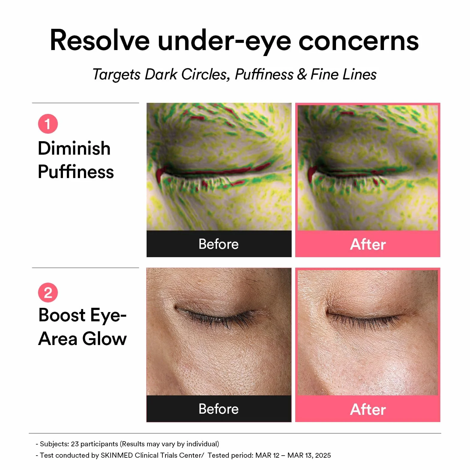 Abib Patchs Oculaires Rétiniens Pdrn Glow Jelly, Coréens Antirides, Collagène, Caféine, Niacinamide, 60 Patchs