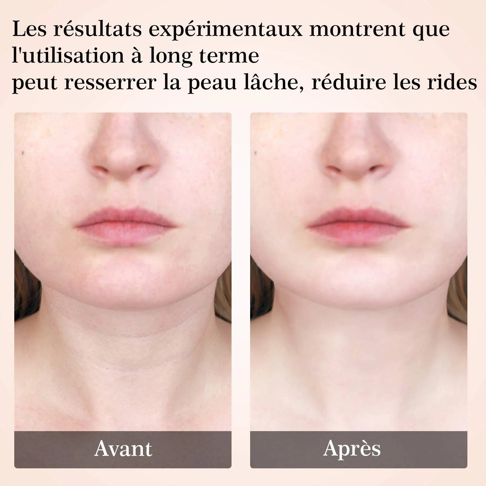 Appareil Anti Rides Visage, ANLAN Appareil de Beauté, Soins de la Peau Dispositif de Beauté avec Lifting EMS Massage, Tonification Pour Le Visage Raffermissement Levage Cou(45℃)