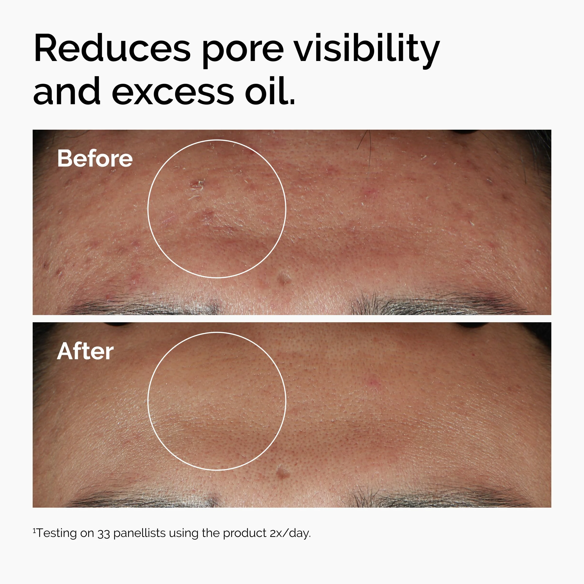 The Ordinary Niacinamide 10% + Zinc 1% Serum 30ml