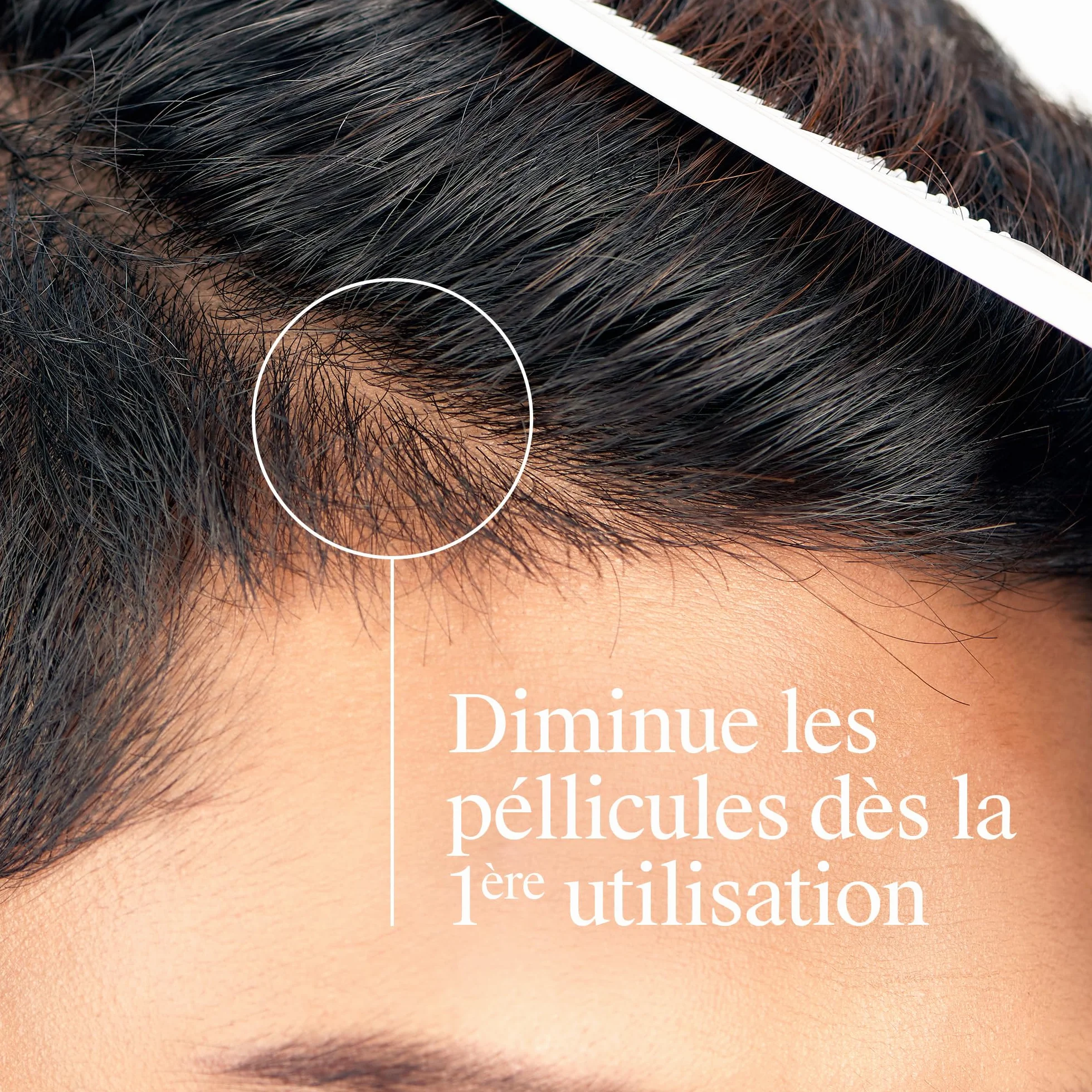 Neutrogena Shampoing Antipelliculaire T/Gel Fort Démangeaisons Sévères 250 mL
