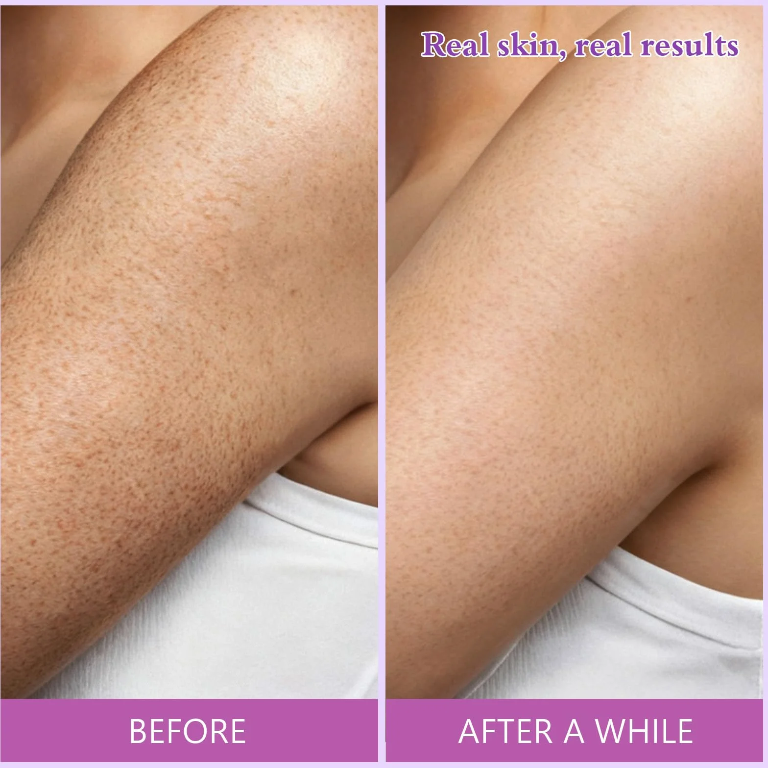 Bâton d'Acide Glycolique 75g 7% Acide Glycolique 0,5% Acide Salicylique Exfoliation Corporelle Douce