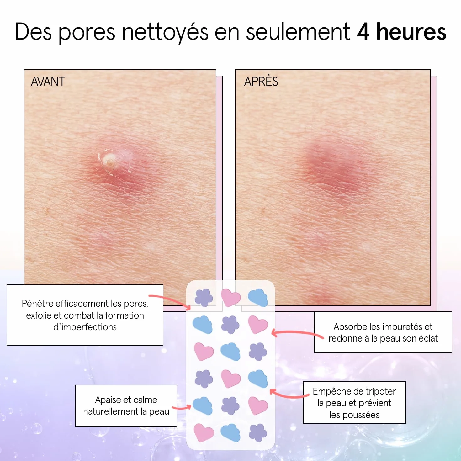 Grace & Stella Patch Hydrocolloïde Visage 36 unités Testés Dermatologues Vegan