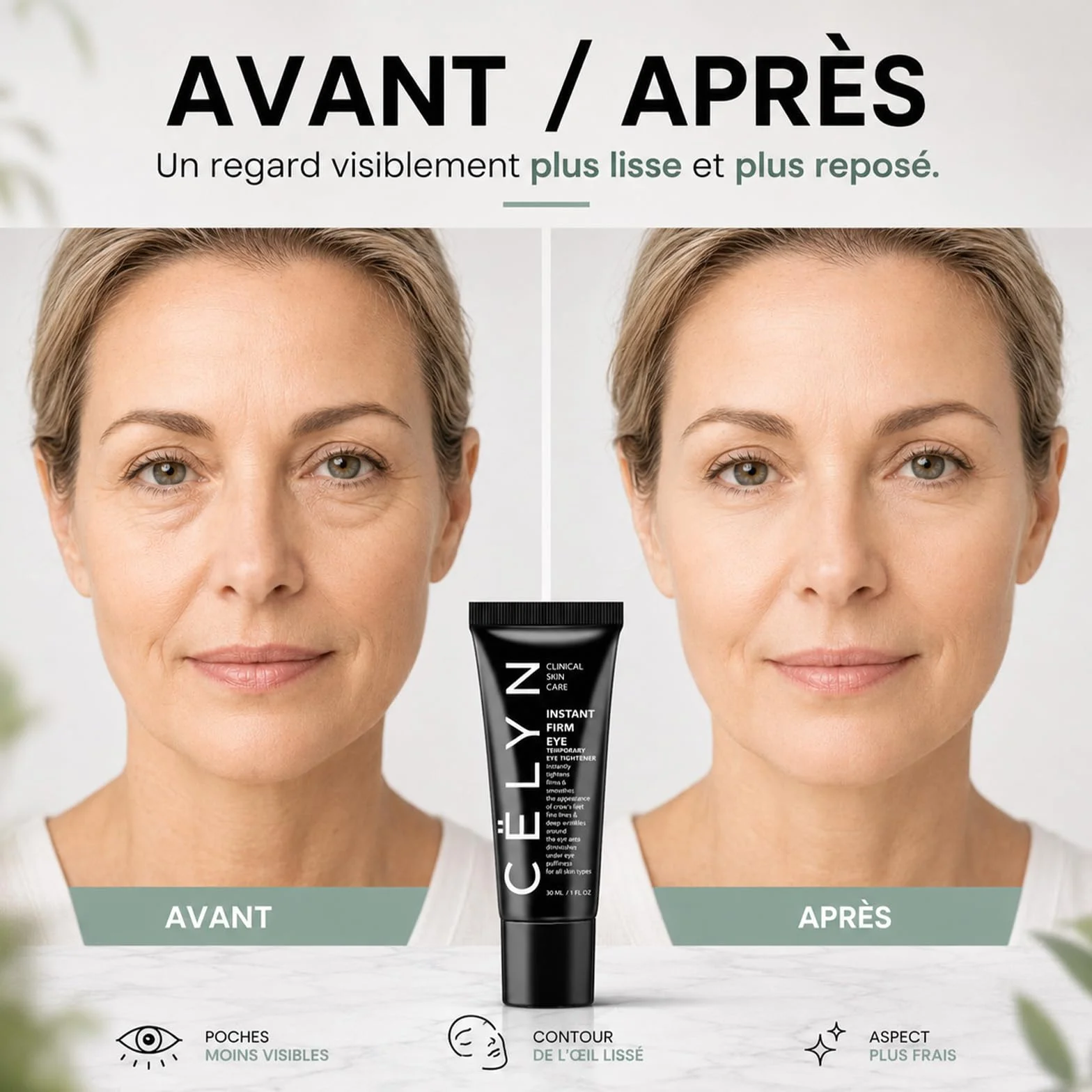 Lyciana Baume Anti Ride Et Anti Cerne – Crème Contour Des Yeux Instantanée, Effet Tenseur, Réduit Poches & Ridules