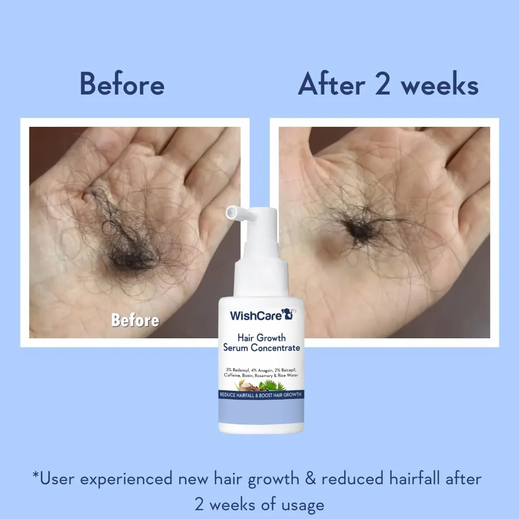 Sérum de croissance des cheveux WishCare avec romarin, Redensyl, Anagain, Baicapil, caféine, biotine