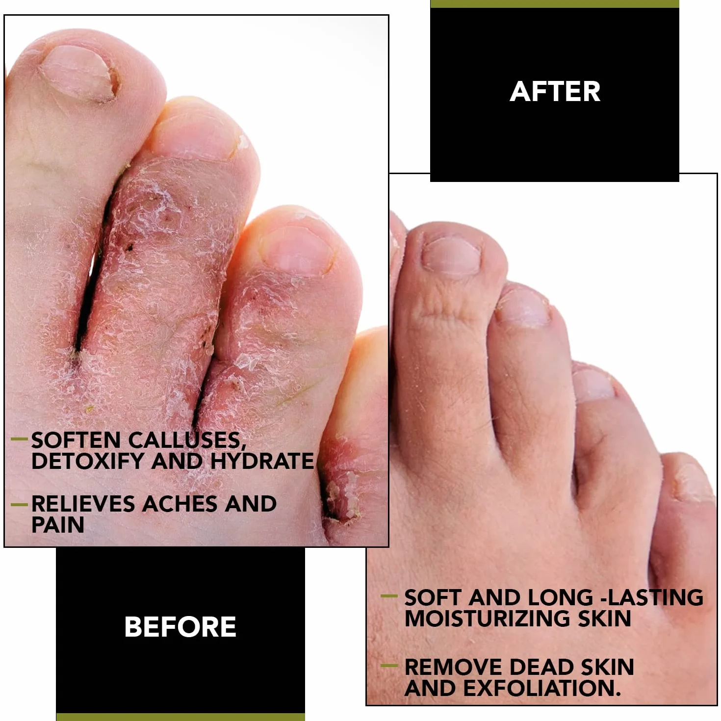 FungusLess Nail and Foot Purifier - Purifiez, Protégez et Rajeunissez vos pieds - Prévenez les bactéries, le pied d'athlète et les champignons.