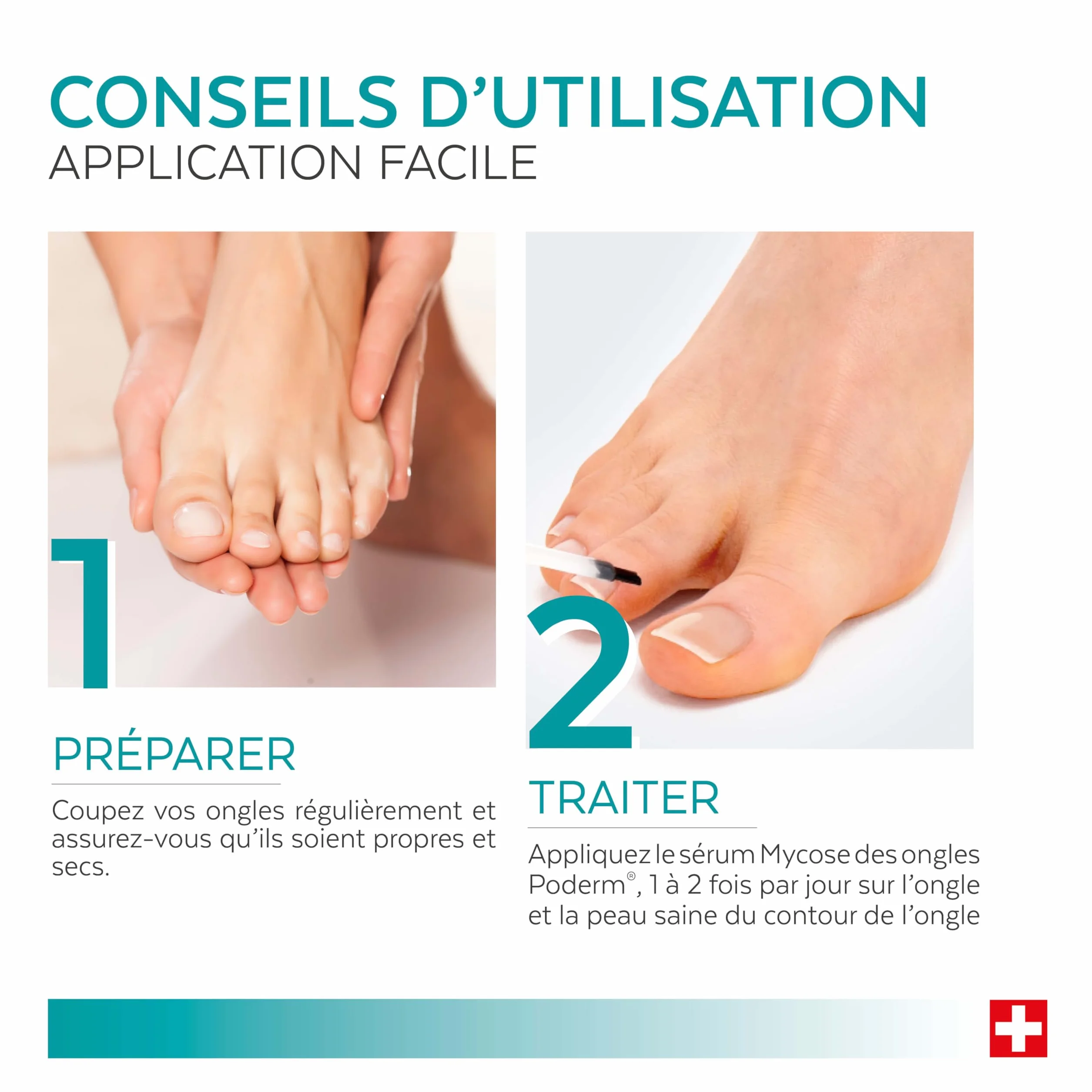 PODERM MYCOSE ONGLE TRAITEMENT 2en1 Antifongique Réparateur Pied Main Swiss Made