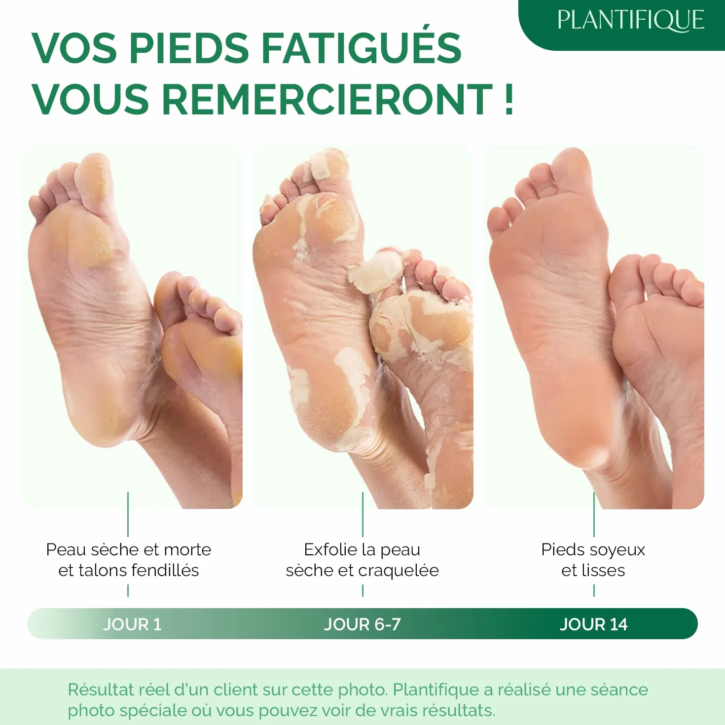 PLANTIFIQUE Masque Pied Peeling Hommes 2 Paires Chaussette Exfoliante Pieds très Secs et Abîmés Gommage Callus Soin Peau Morte