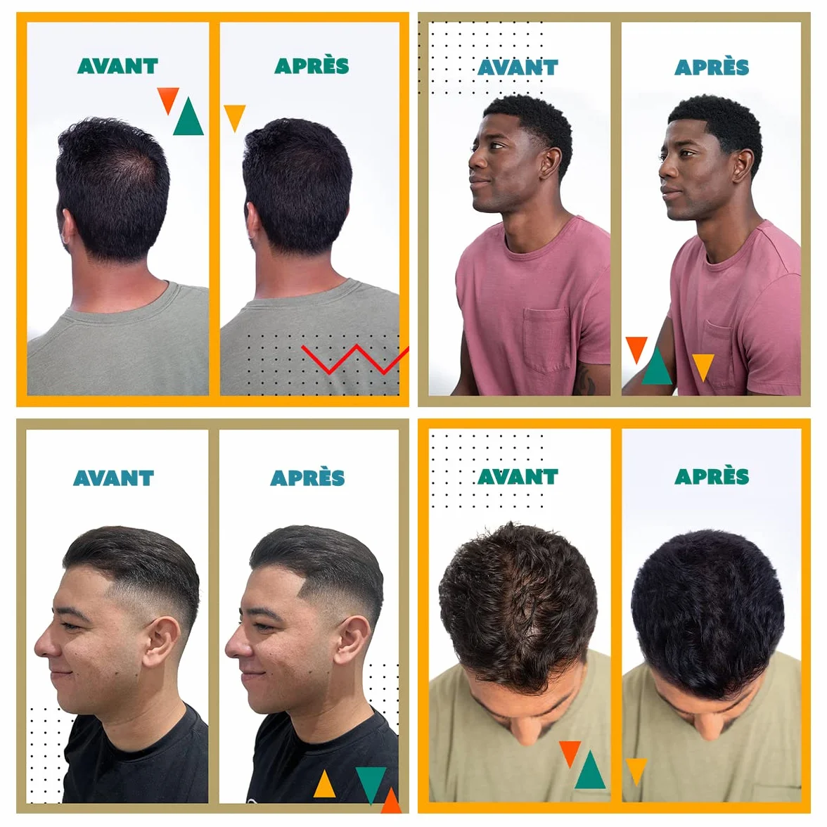TOPPIK Fibres Capillaires Densifiantes Kératine Brun Cheveux Aspect Naturellement Epais