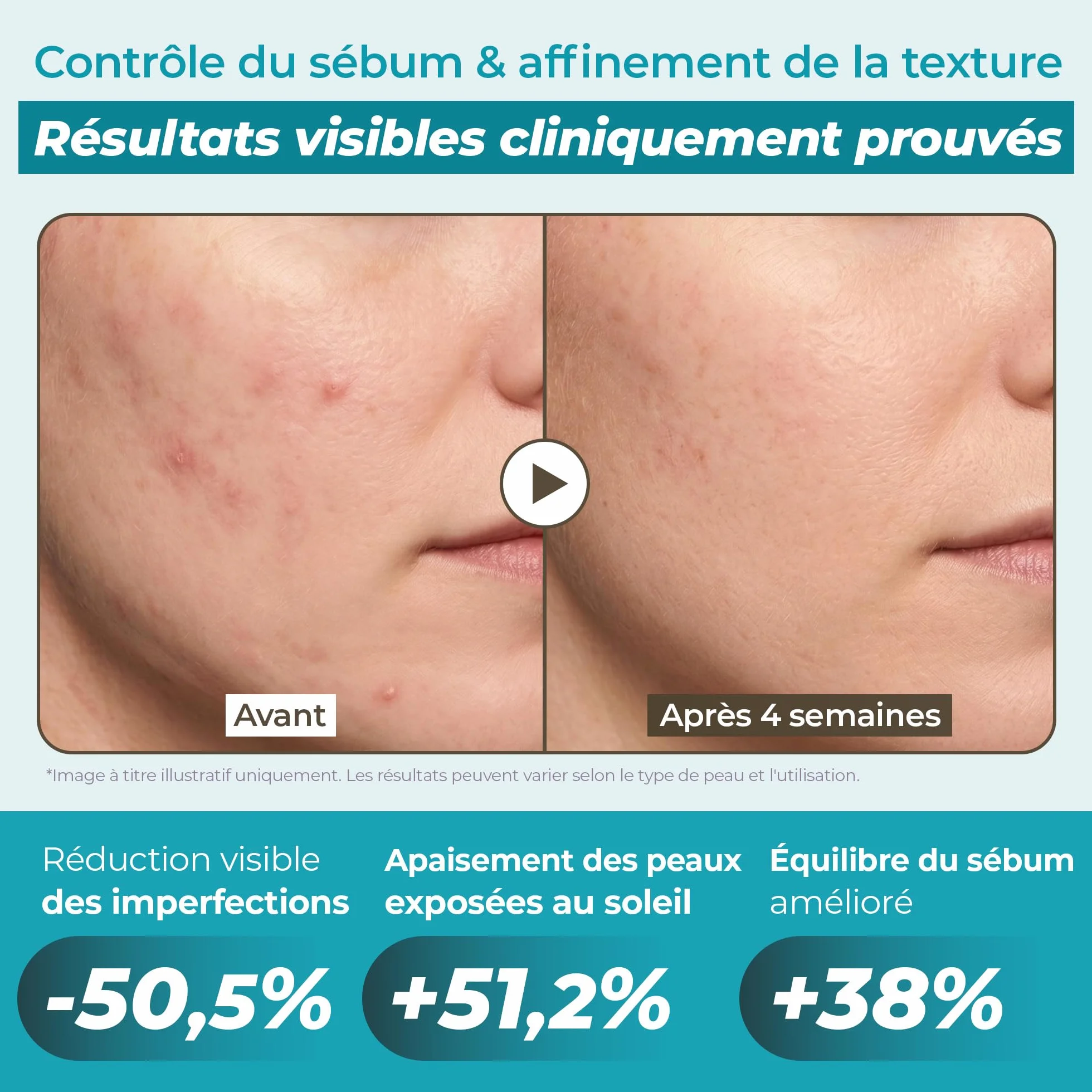 JUMISO Mucine d'escargot 95% + essence de peptide, sérum hydratant pour peaux sèches, hydratation quotidienne en profondeur
