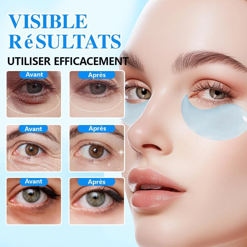 Patchs Yeux au Collagène Masque Hydratant Anti Cernes Poches Contour des Yeux