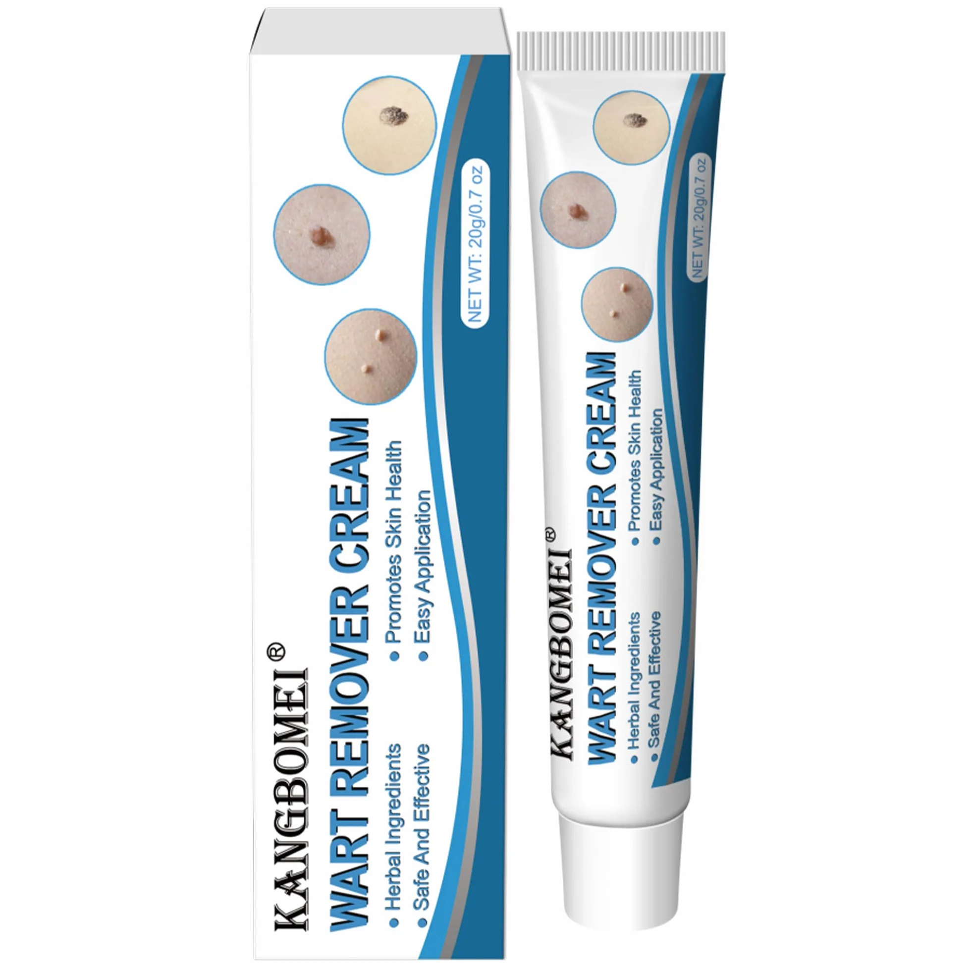 Crème anti-verrues kit d'élimination des acrochordons 20g