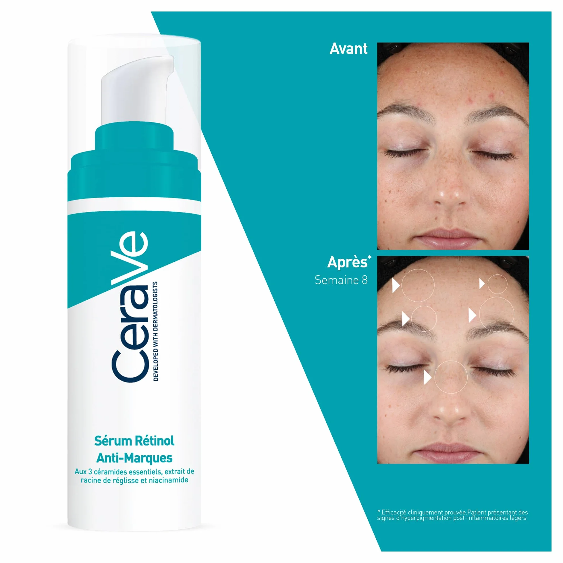 CeraVe Sérum Retinol Anti-Marques 30 ml