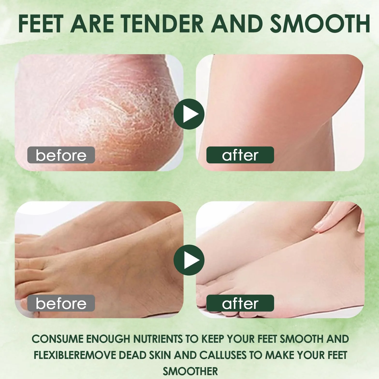 Masque Pieds Peeling Exfoliant Hydratant Peau Lisse Aloès + Avocat 2 Paires