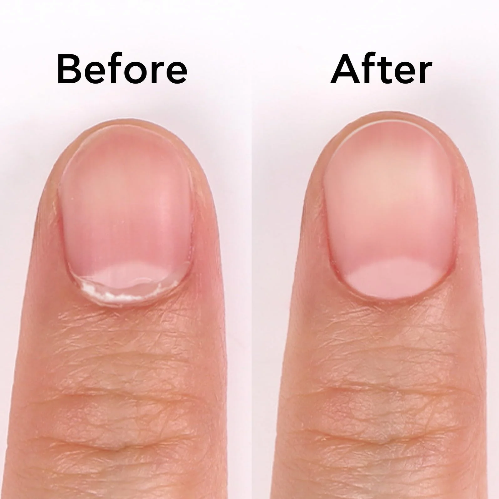 BLUESKY Dissolvant Cuticules 15ml - Soin pour Ongles Naturels, Gel et Acrylique
